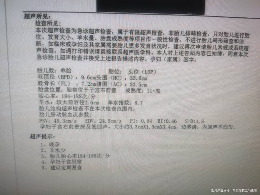 都快生了胎心好快啊大夫说羊水也不多是不是必须