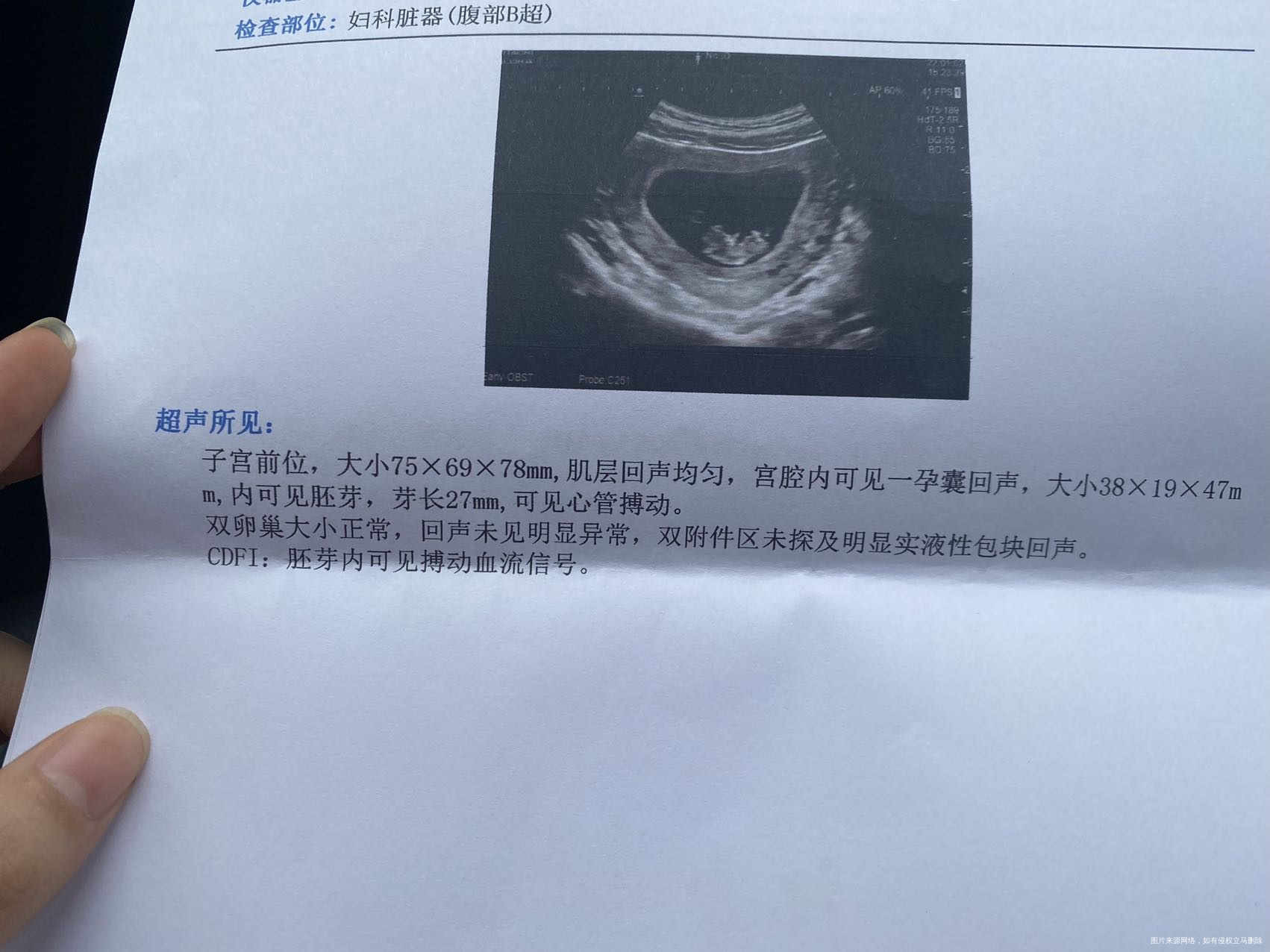 孕9周➕中度小孕囊要怎么办