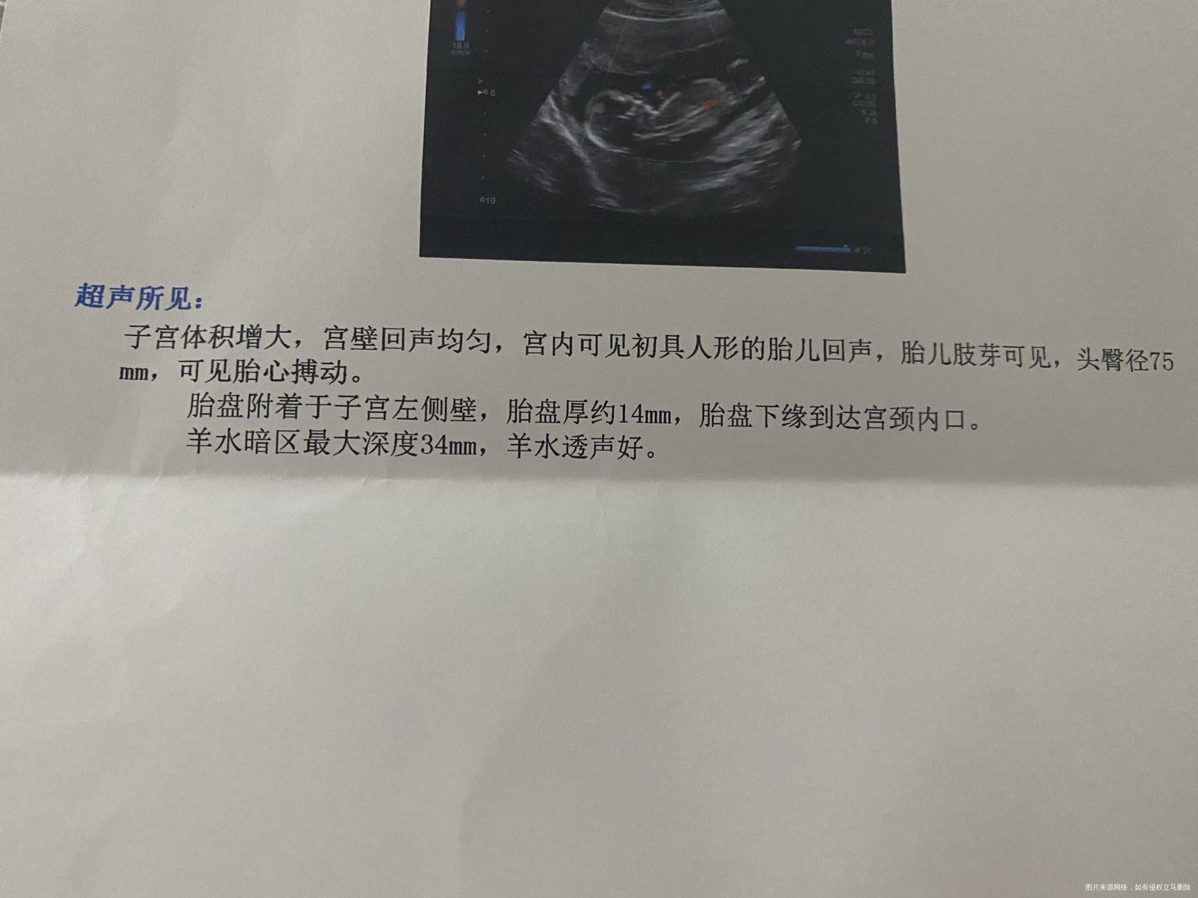 怀孕13周➕胎盘下缘到达宫颈内口可以坐6个多