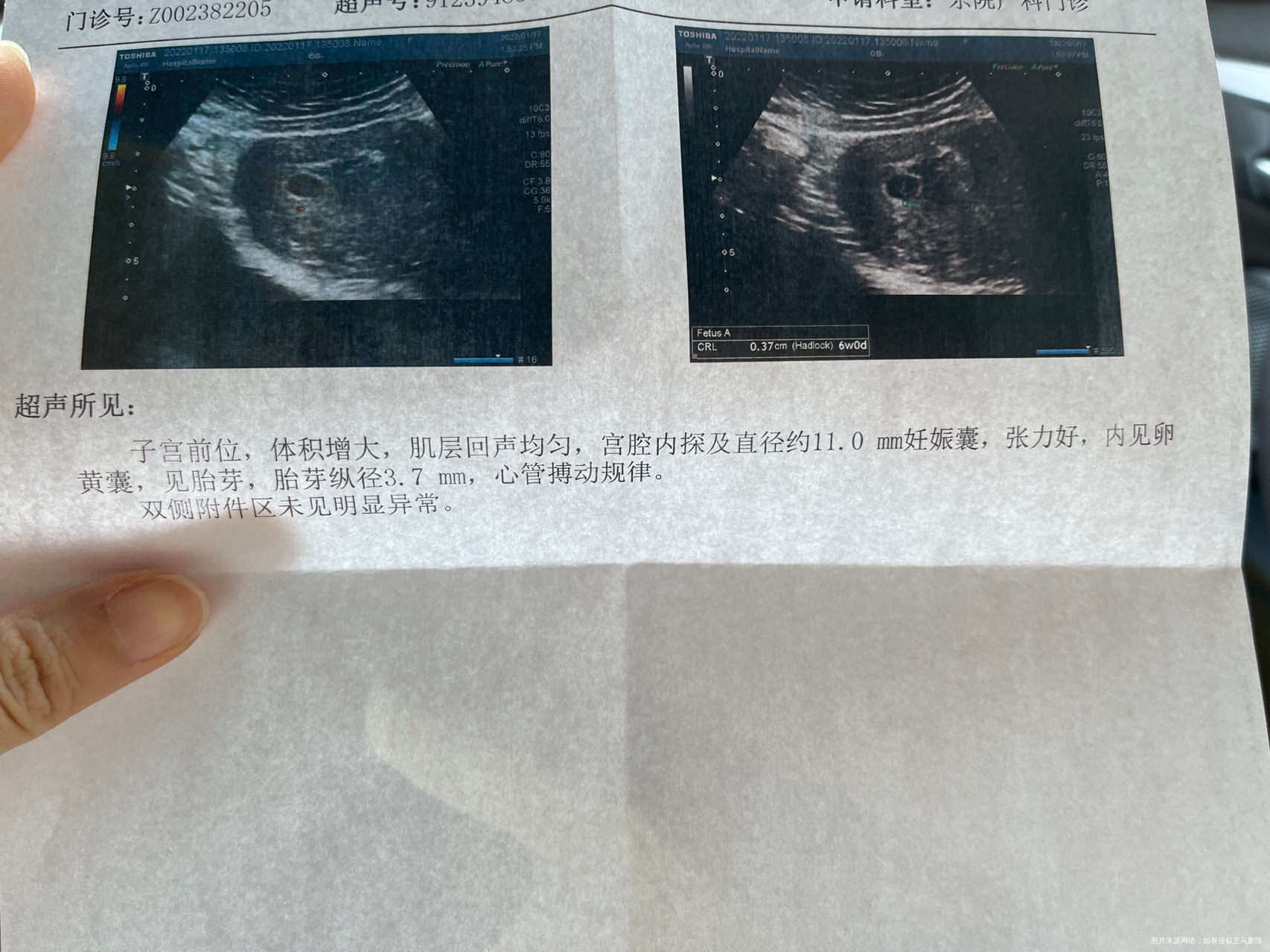 目前怀孕6周hcg3292翻倍差但已出胎心胎