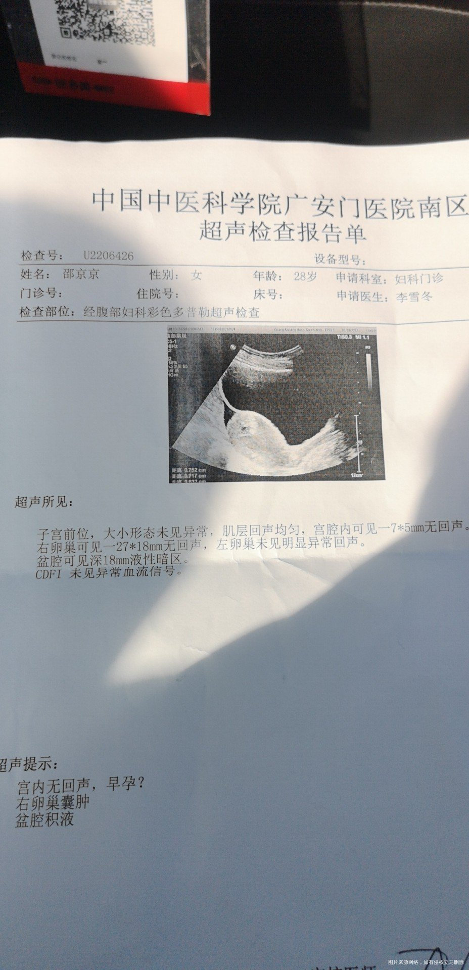 末次月经1223号今天早上上厕所卫生纸上少量