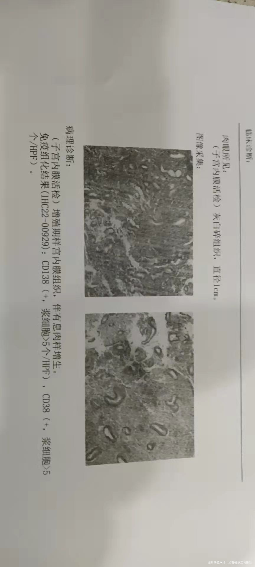 今天宫腔镜的病理出来了没来得及去看医生麻烦帮