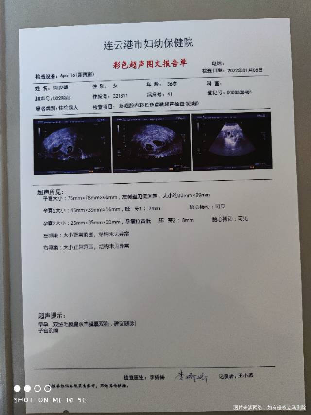 孕七周有少许褐色分泌物不断这是刚查的彩超