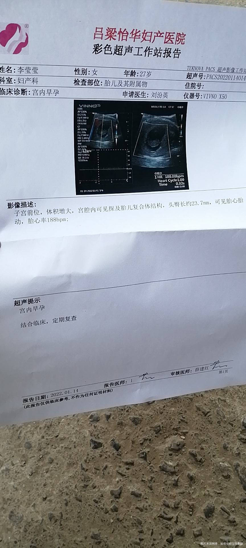 孕九周麻烦看一下b超咋样