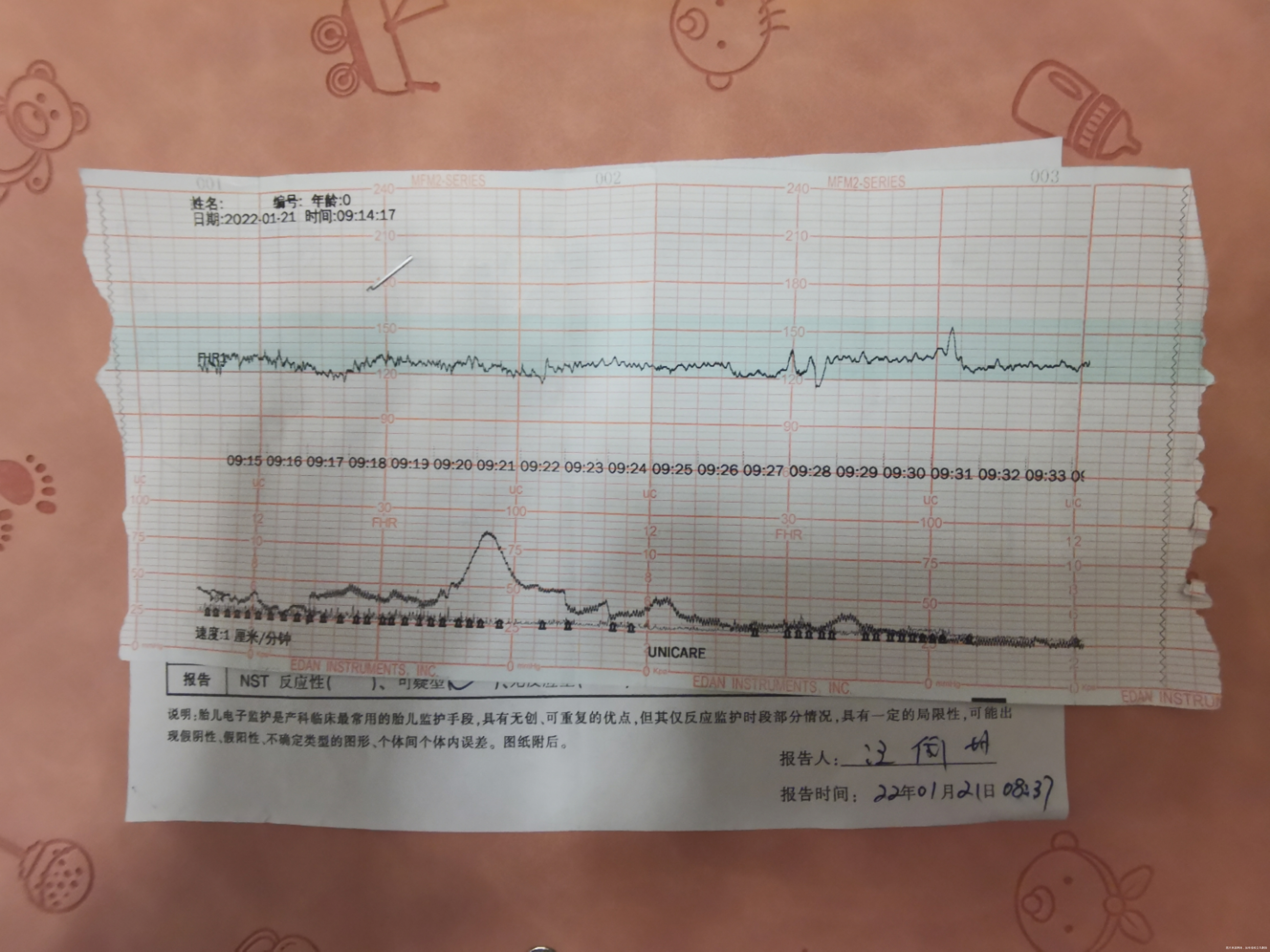 孕37+4今天做了3次胎心监护都没过麻烦医生
