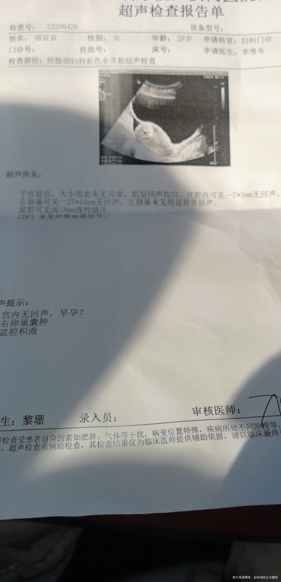 末次月经1223号今天早上上厕所卫生纸上少量