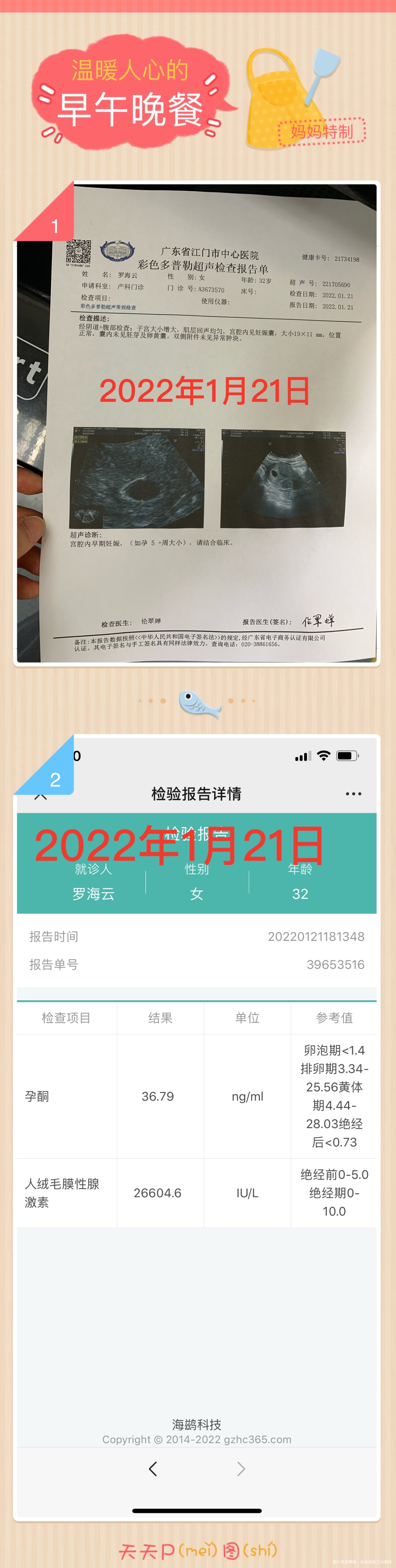 2022年12月21日移植的囊胚2枚今天B超