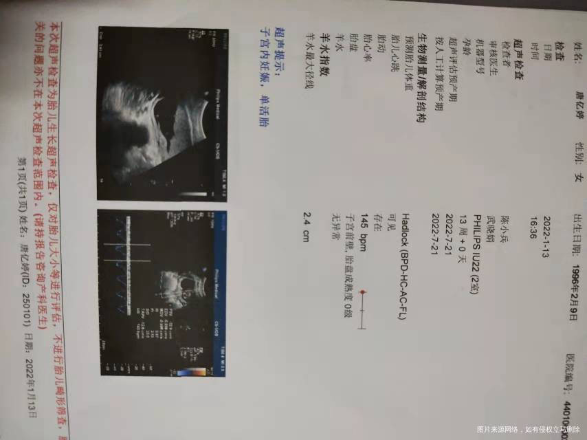 因为NT值高所以今天做了绒毛穿刺手术报告出来