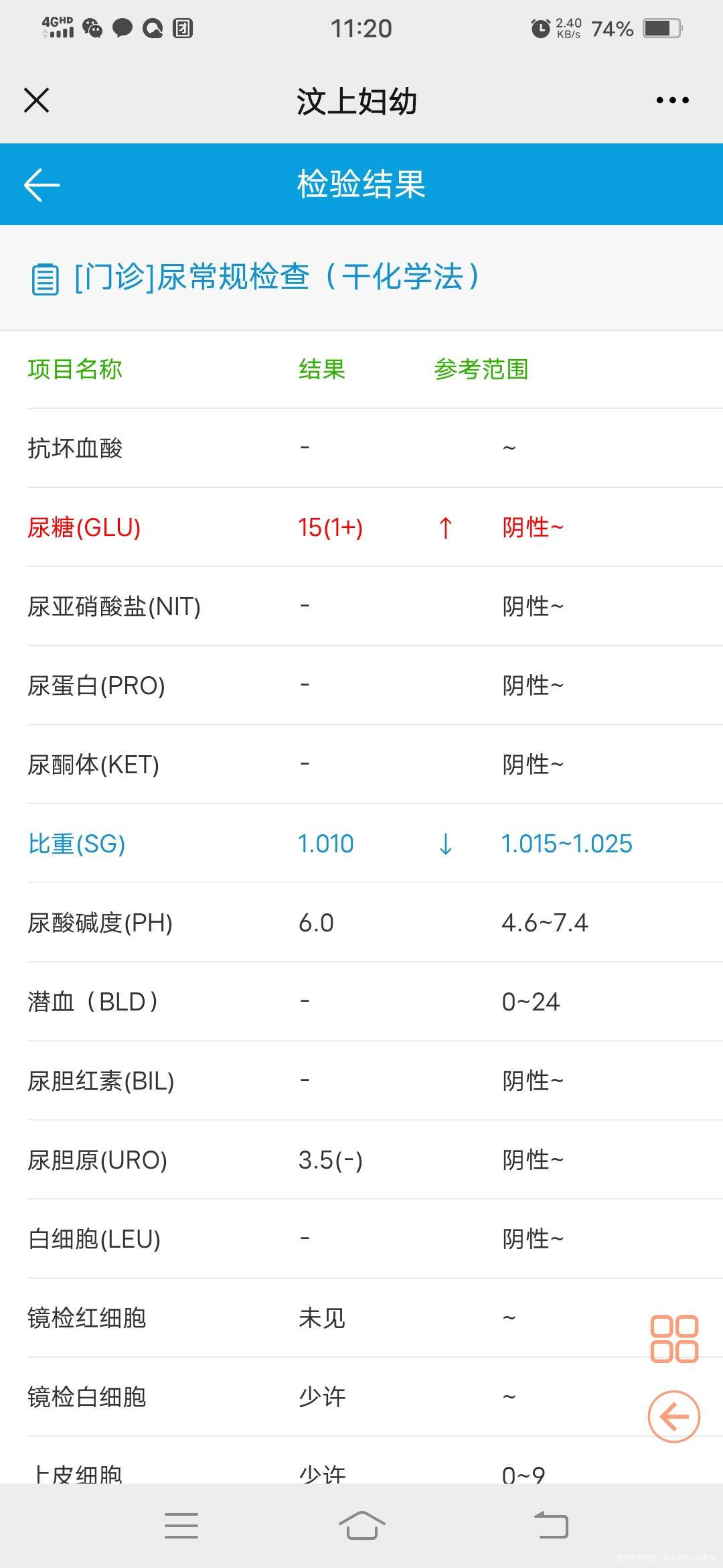 现在怀孕30周尿糖高是怎么回事24周检查的糖