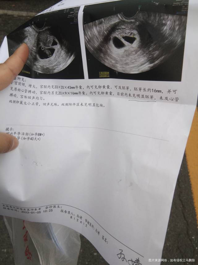 医生你好11月25号移植刚刚又有一点出血了不