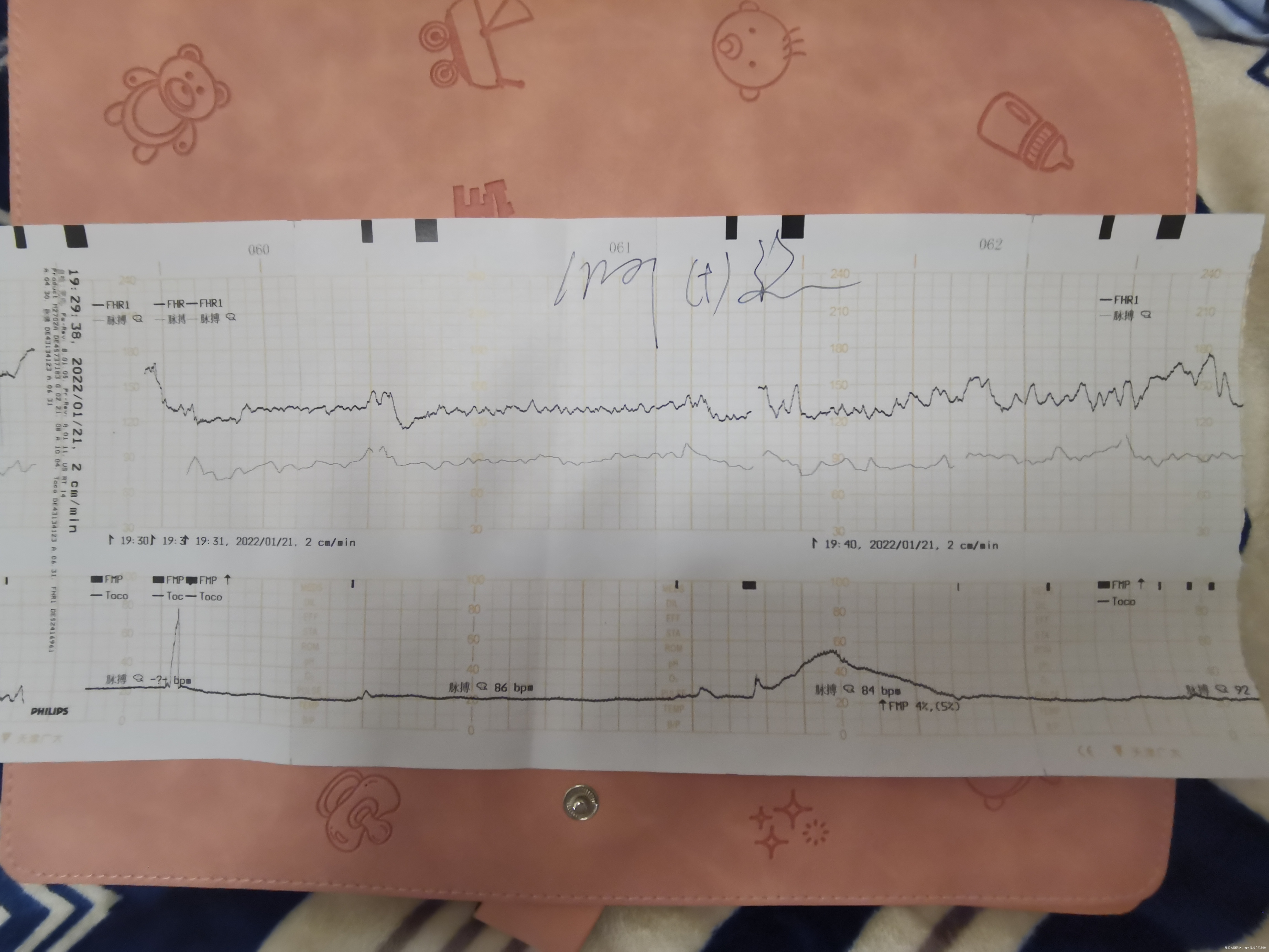 孕37+4今天做了3次胎心监护都没过麻烦医生