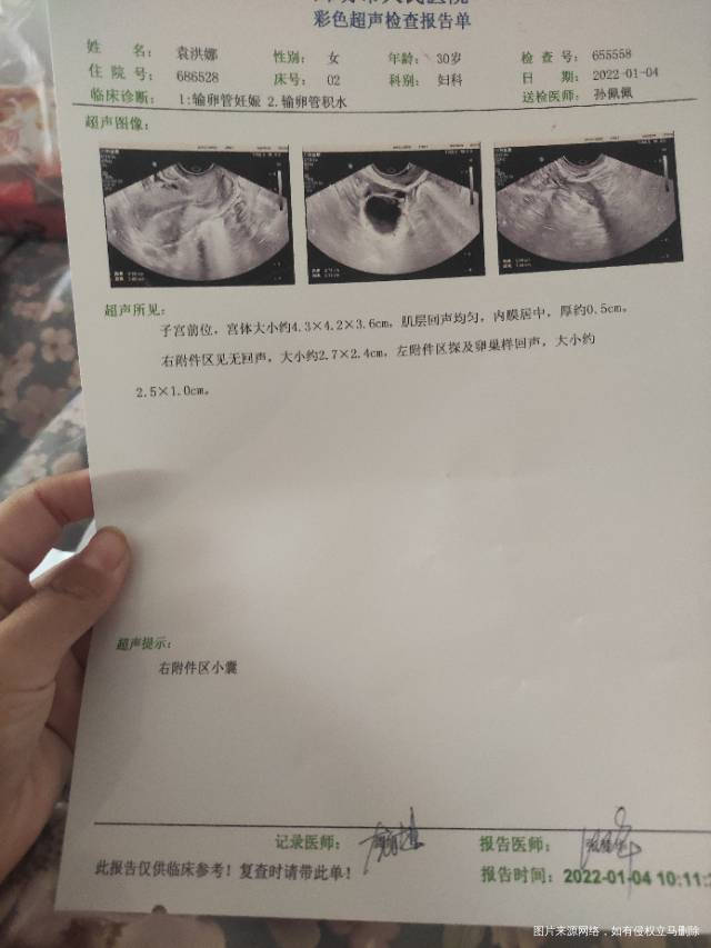 我想问一下这个卵巢囊肿是长了吗我是10月查出
