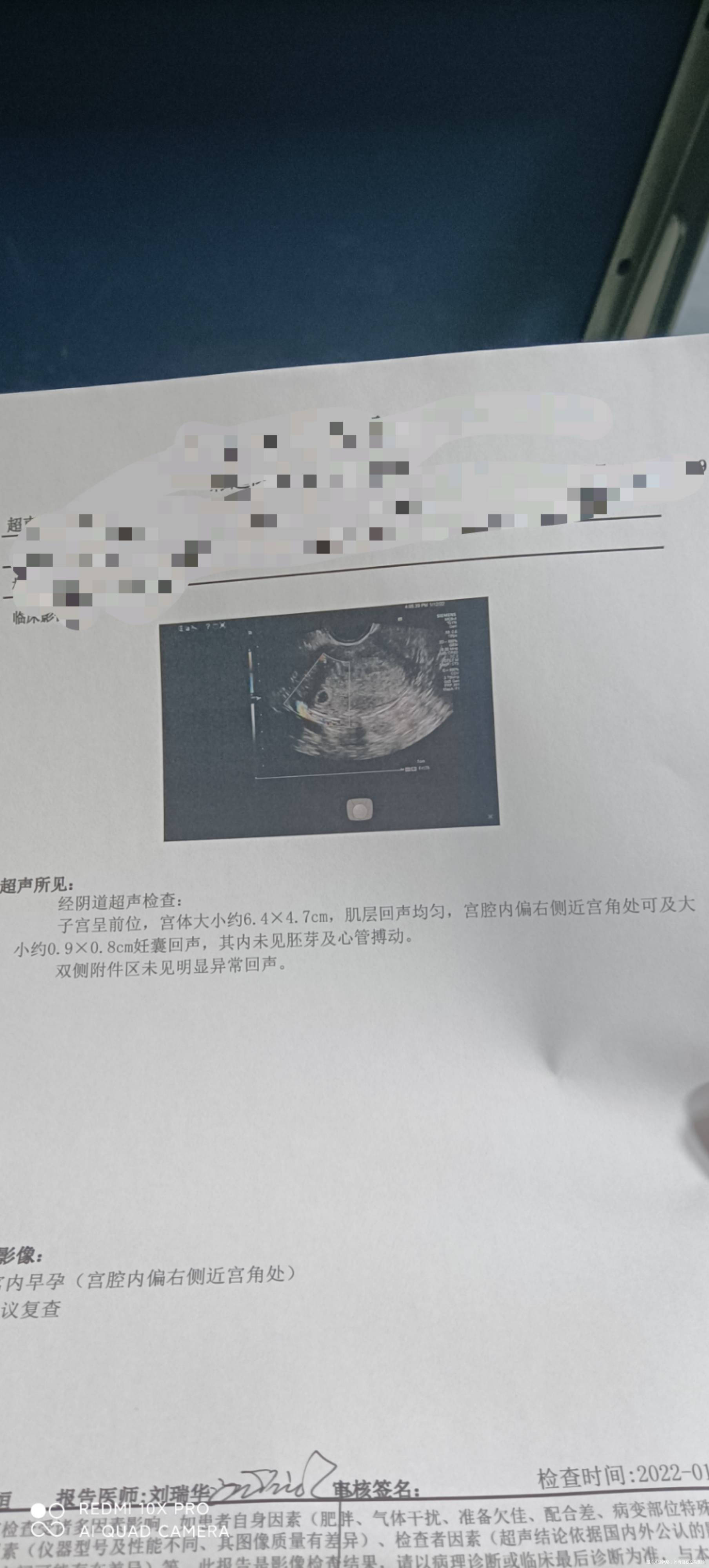 孕40天做阴超有影响吗孕囊偏宫角出怎么办