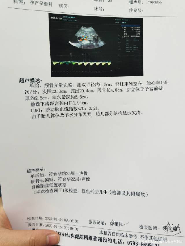 孕周24+4做的B超检查宝宝腿短两周有什么办