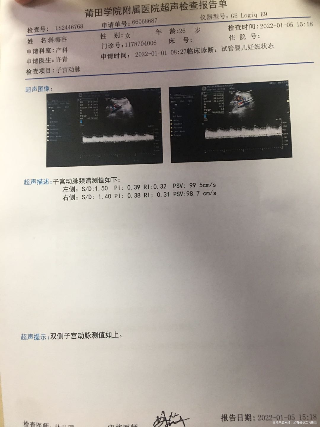你好医生9号做的紧急环术第一张是20号的彩超