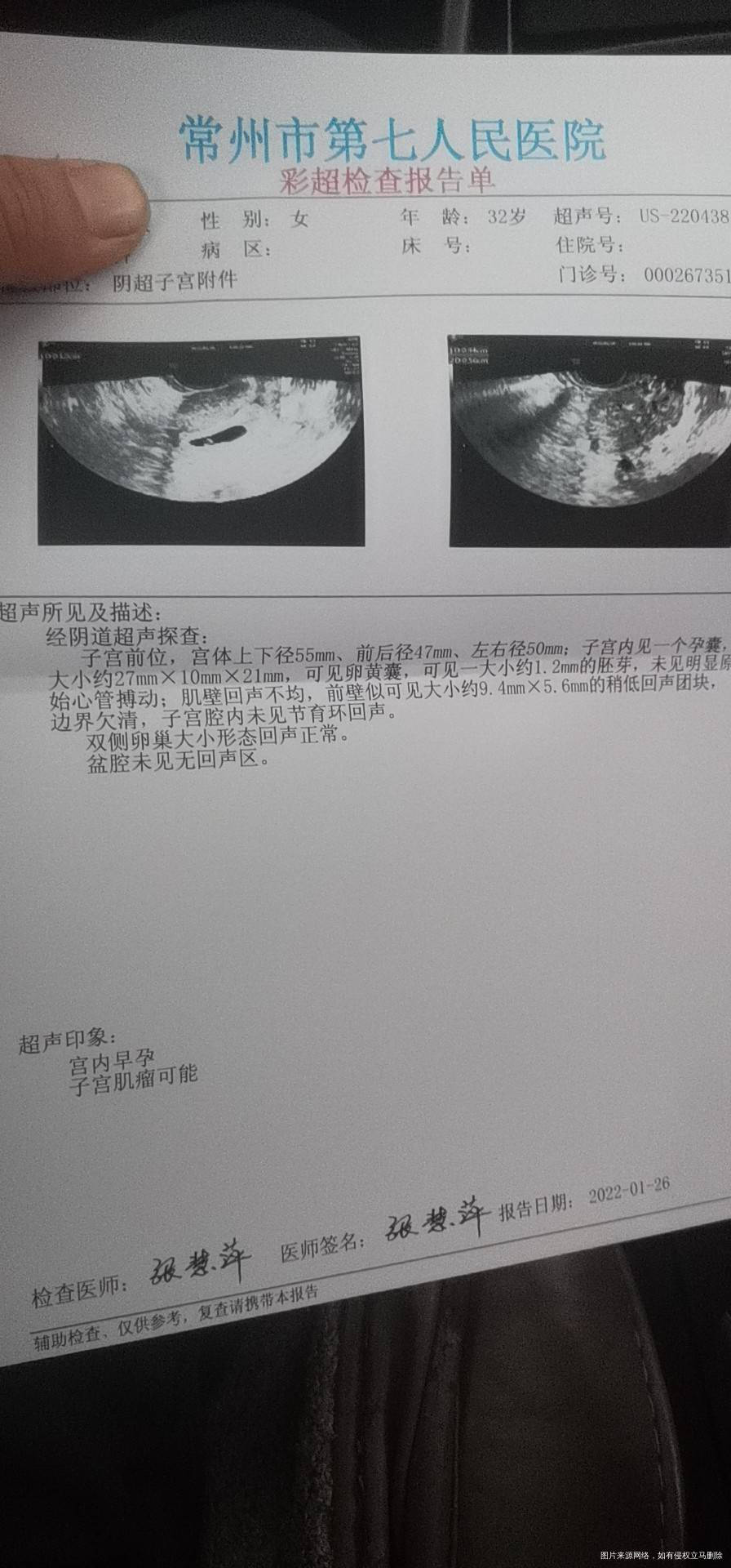 好多个医院都看过检查也就惊喜活率有点低其他没