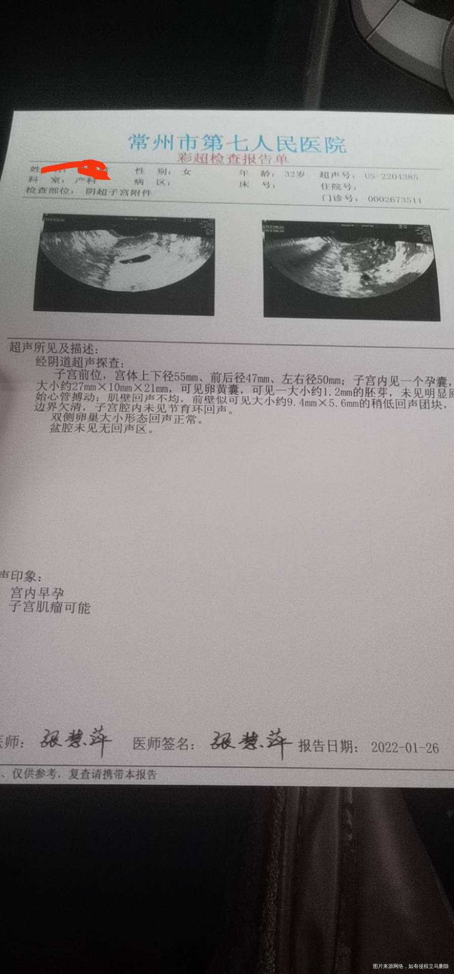 这次检查没出现胎心检查也出来了不知道结果如何