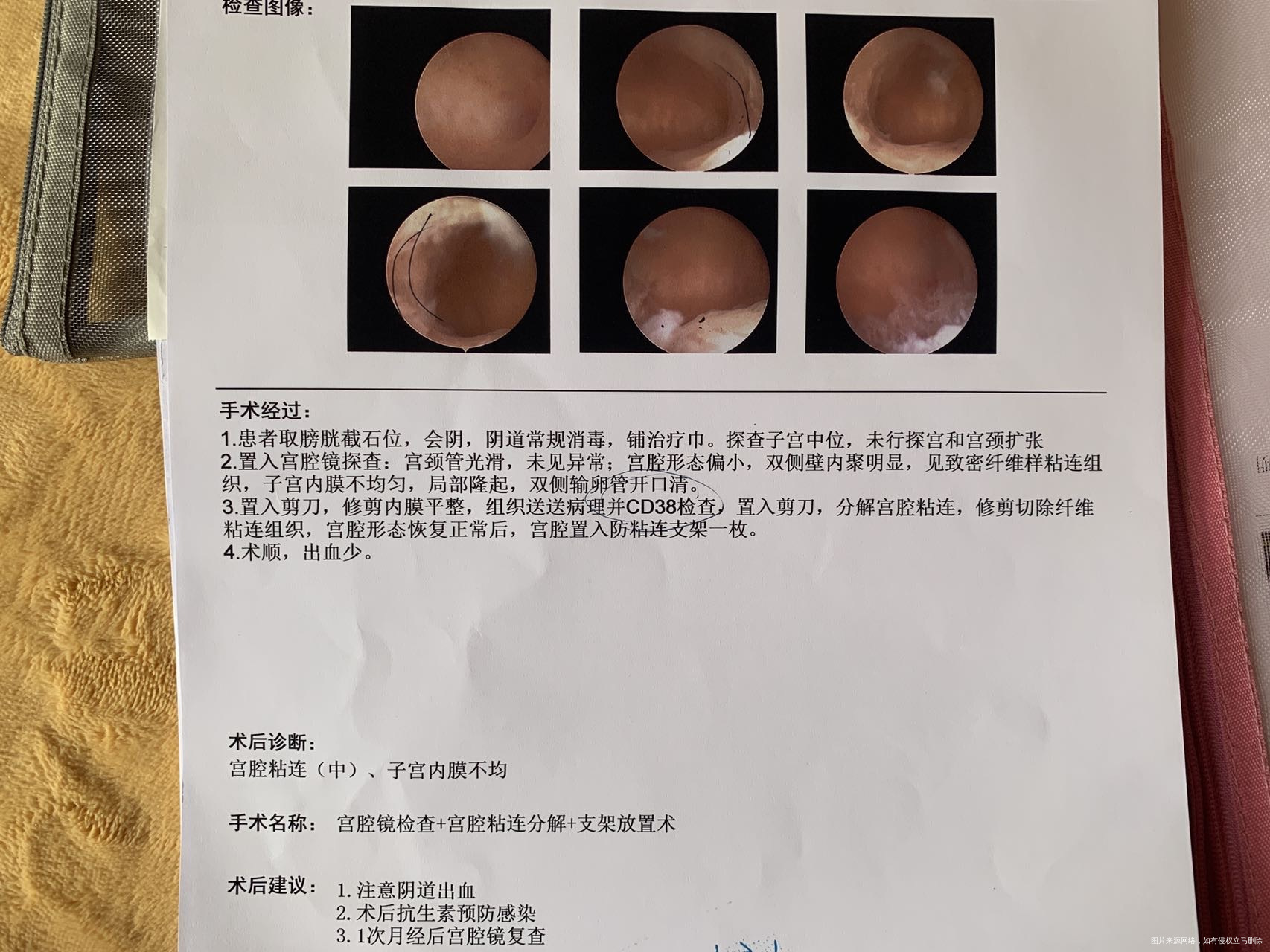 1222做的宫腔镜病例报告有医生帮忙看看吗是