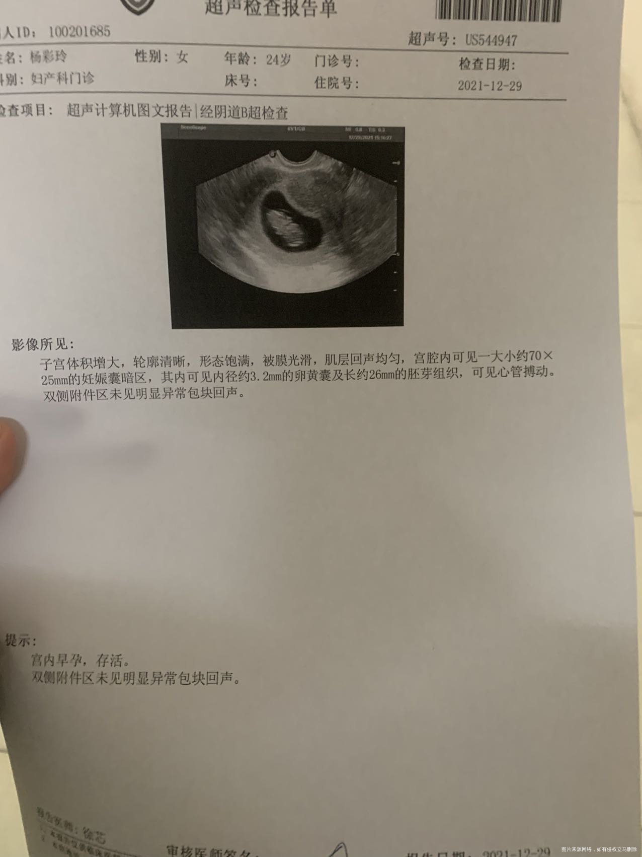 1025末次月经12月29日武警医院阴超胚芽