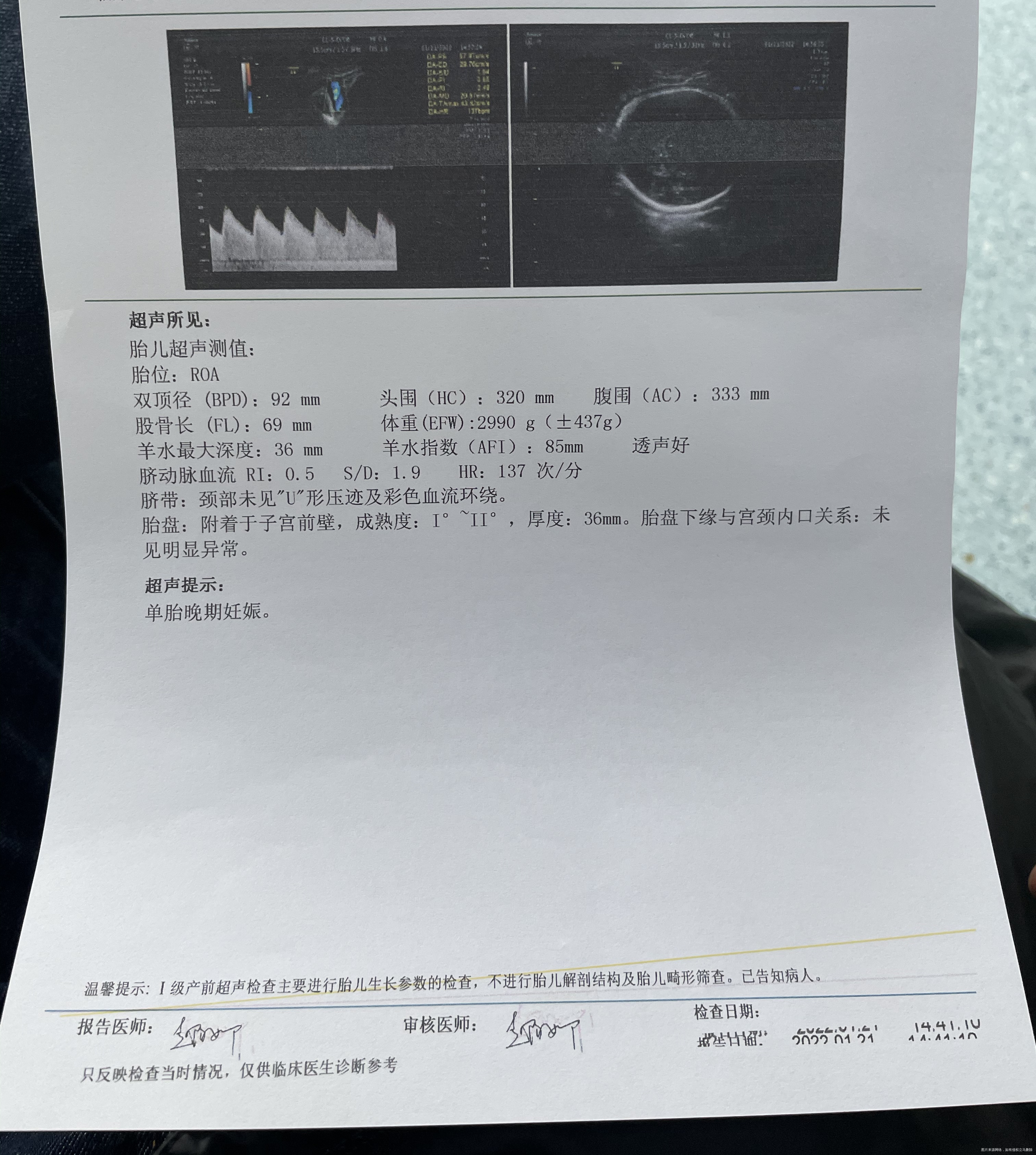 孕37周+4b超如下请医生看下指标都正常吗谢