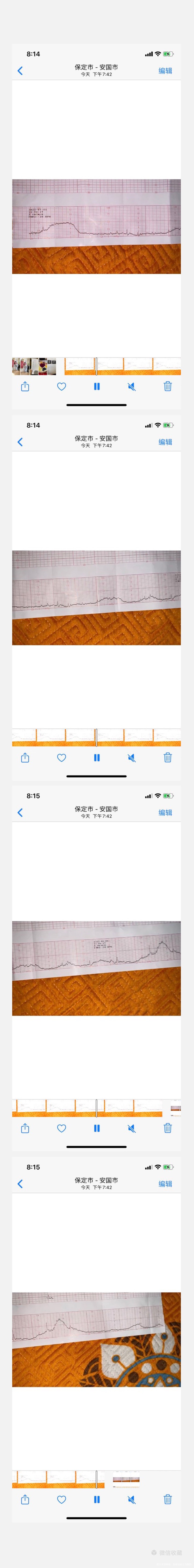 孕33周加3宫缩正常不