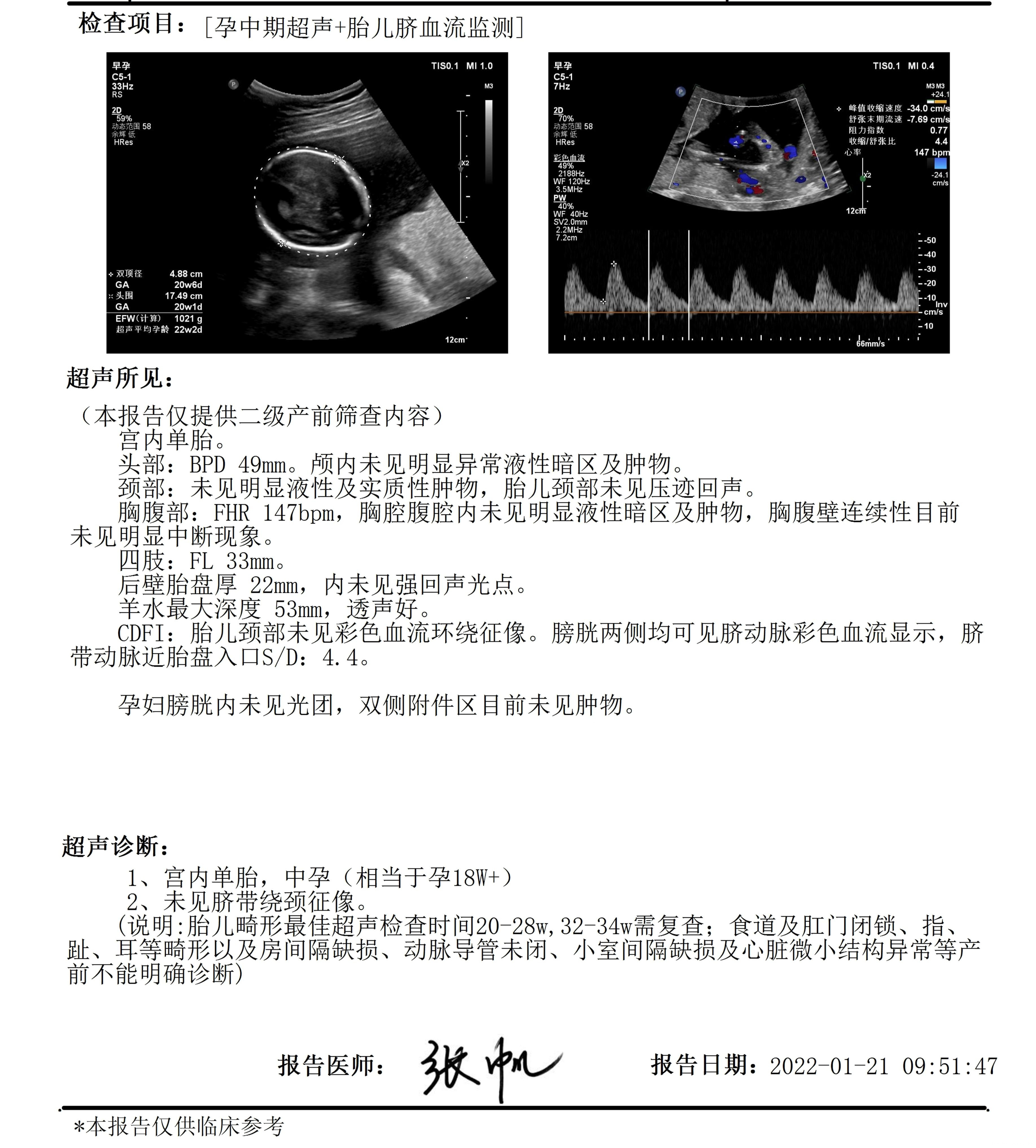 医生好本人93年出生目前怀孕20周末次月经9