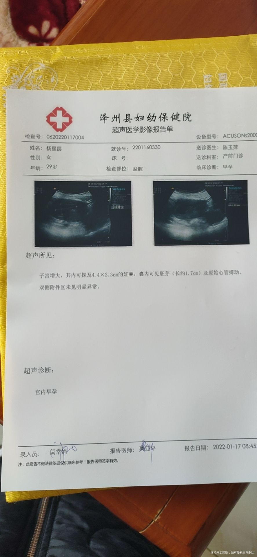 孕七周加5天做的hcg是8万多今天孕8周加5