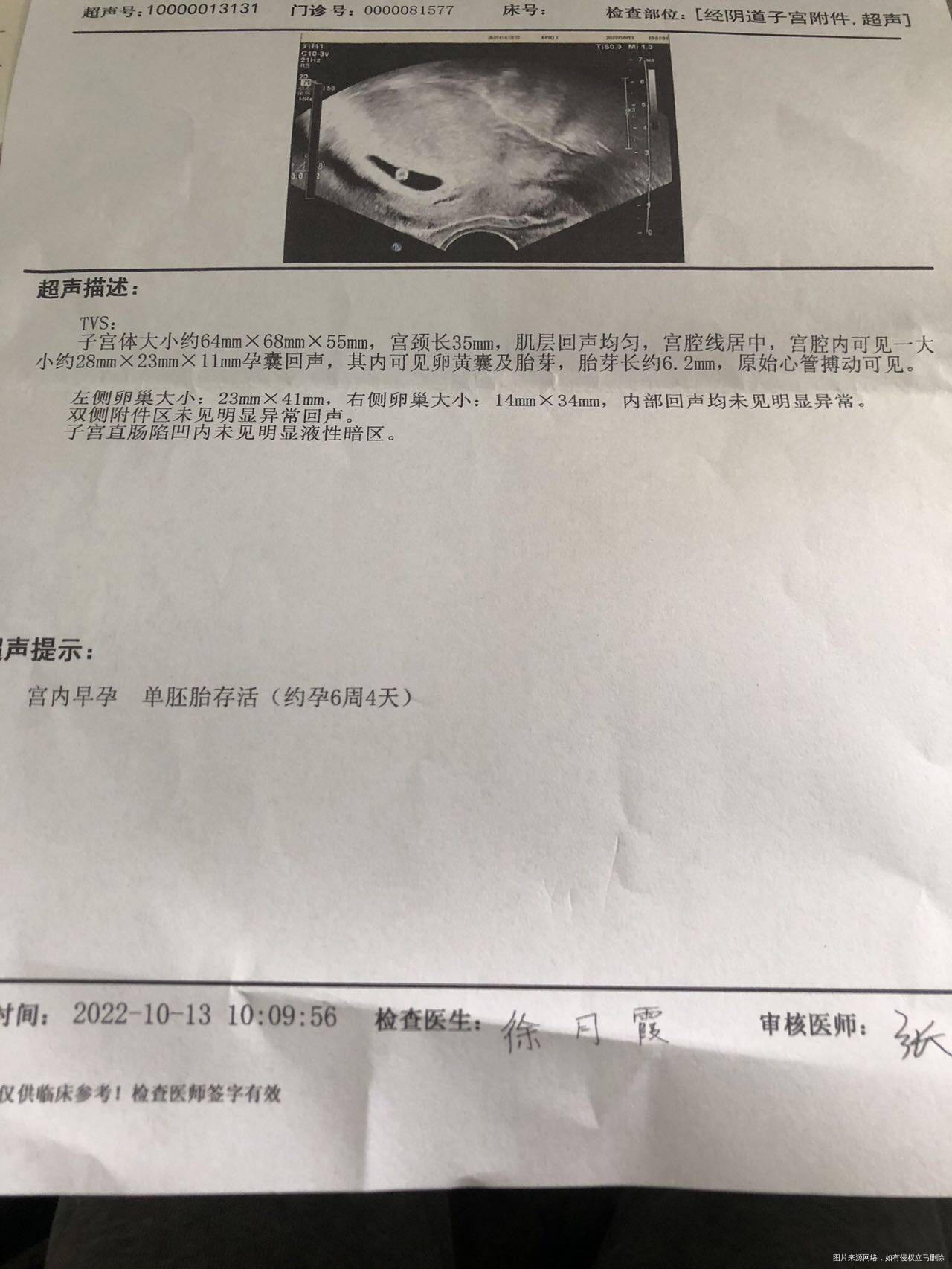 10月13号做的b超和化验的孕酮10月16号