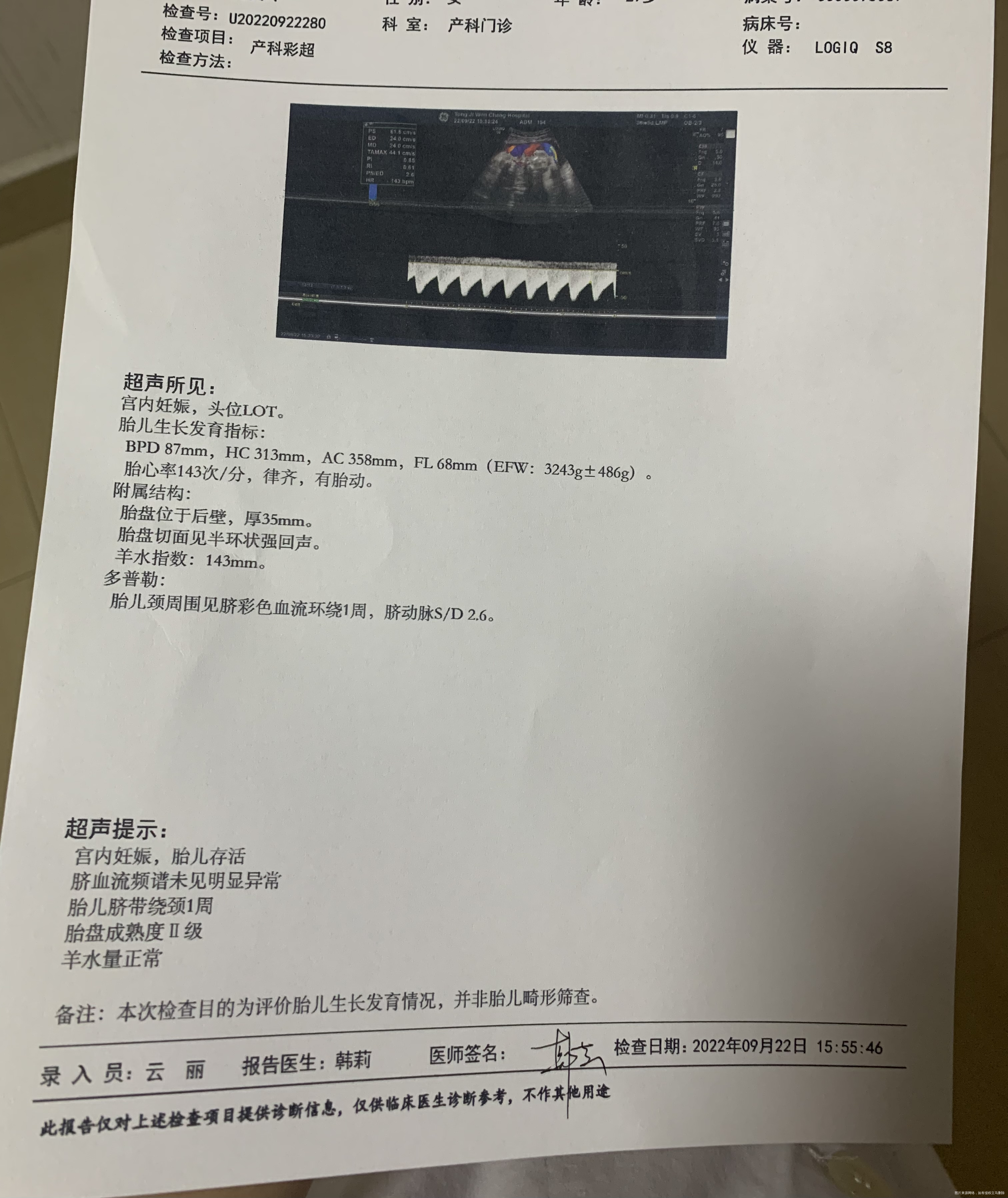 第一张是38+4做的彩超第二张是39+3的第