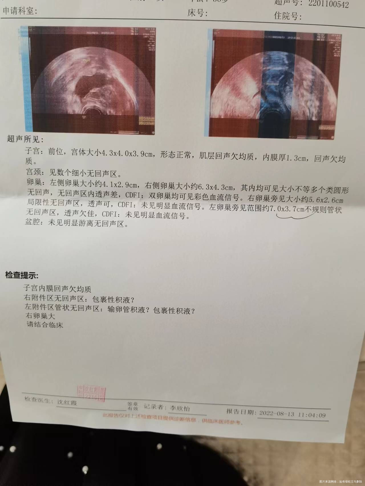 检查所见子宫内膜回声欠均质右附件区无回声区包