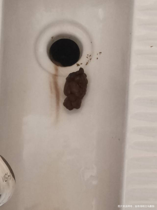 怀孕5个多月了便秘特别厉害大便又干又粗还和羊