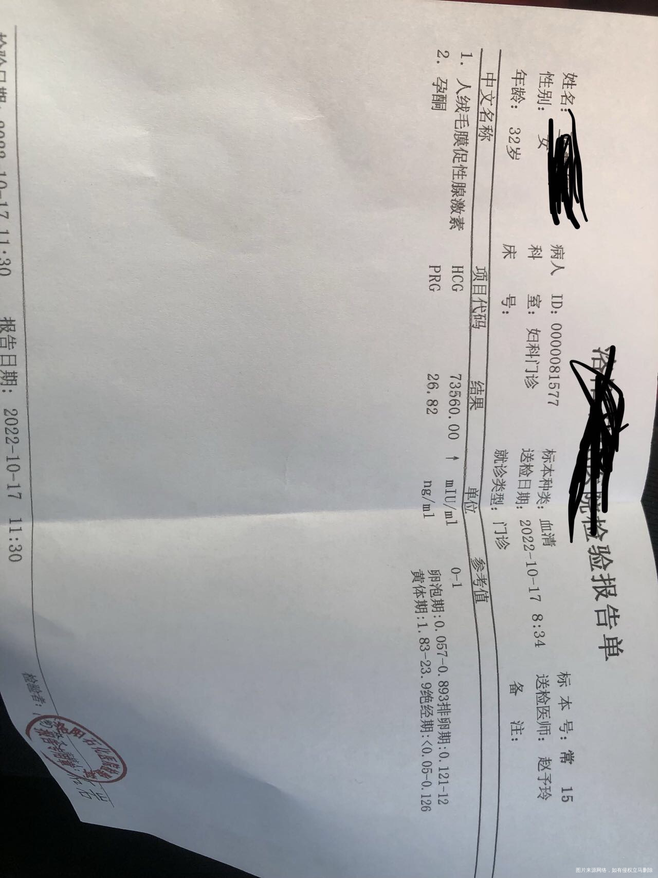 10月13号做的b超和化验的孕酮10月16号