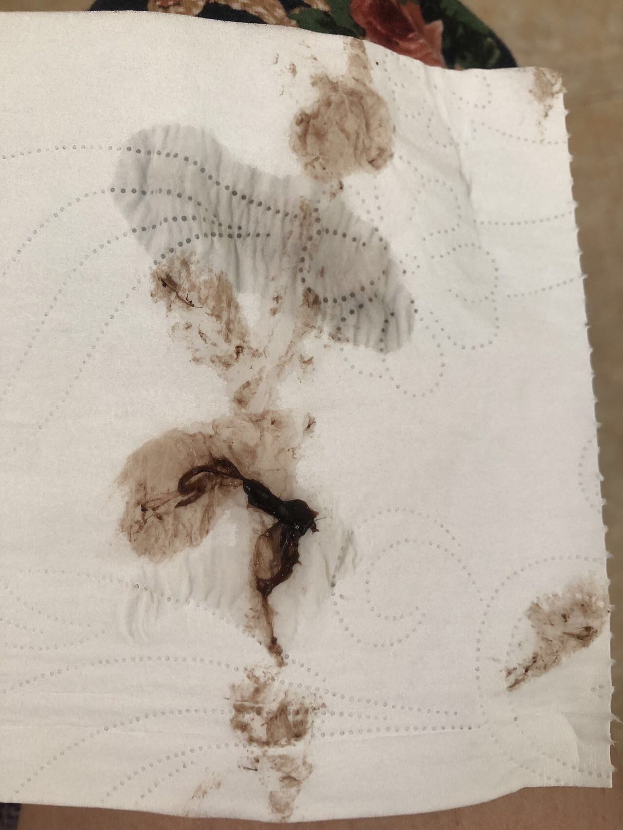 昨天白天少量出血晚上没有出血今天早上有褐色东