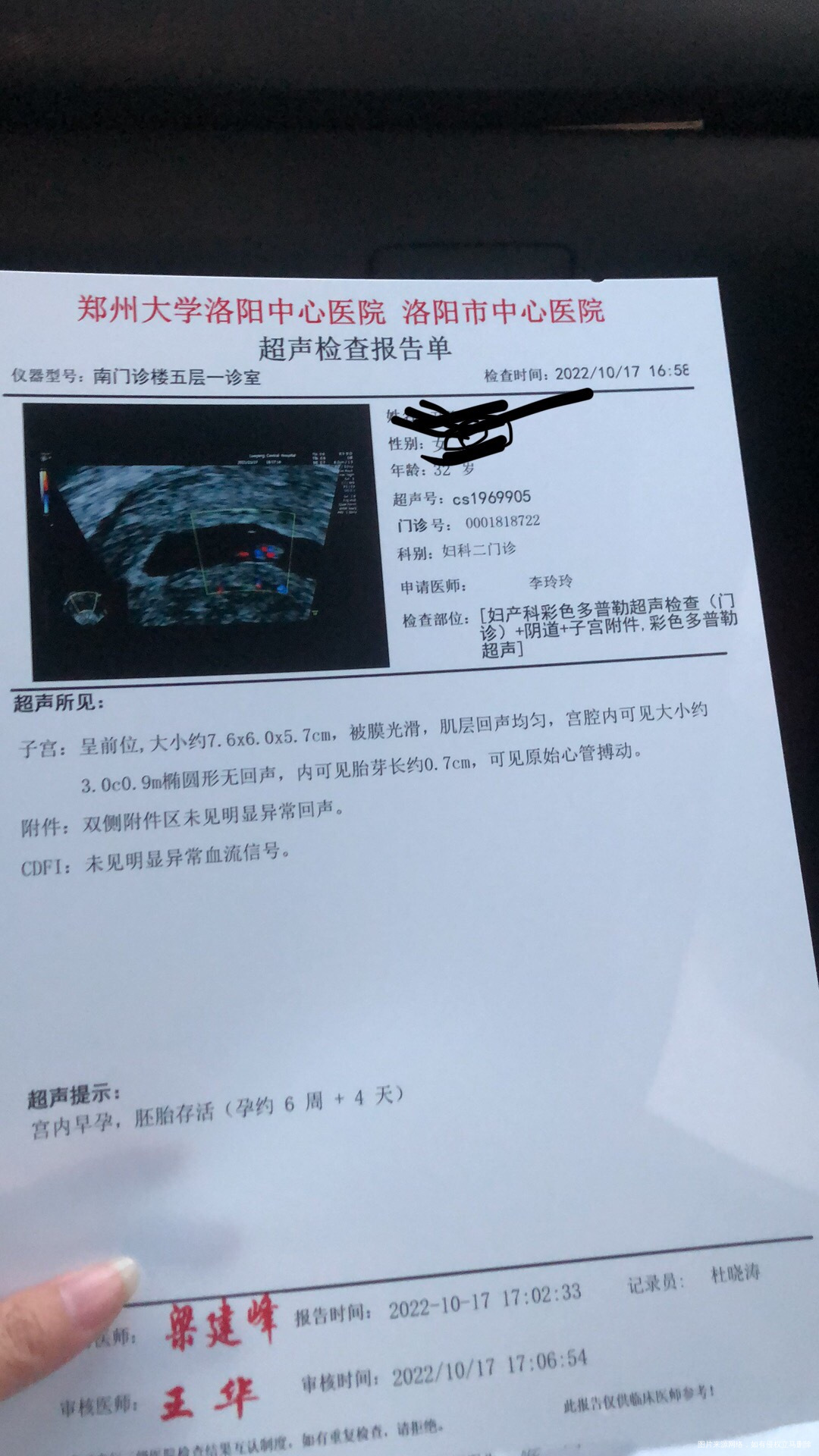 今天少量出血打了一针20mg的黄体酮针做的b