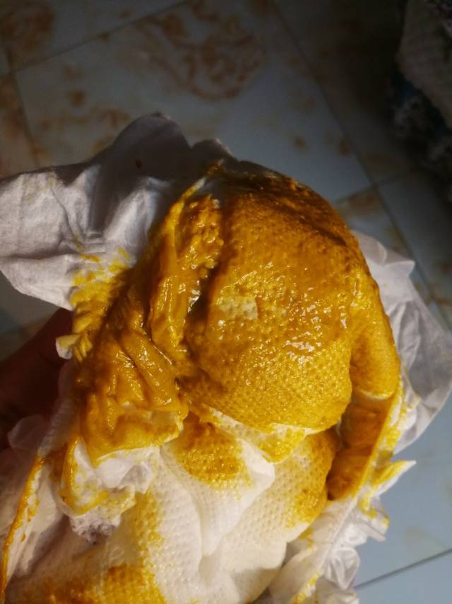 婴儿一直拉酸臭便便有奶瓣和粘液拉稀便便这怎么