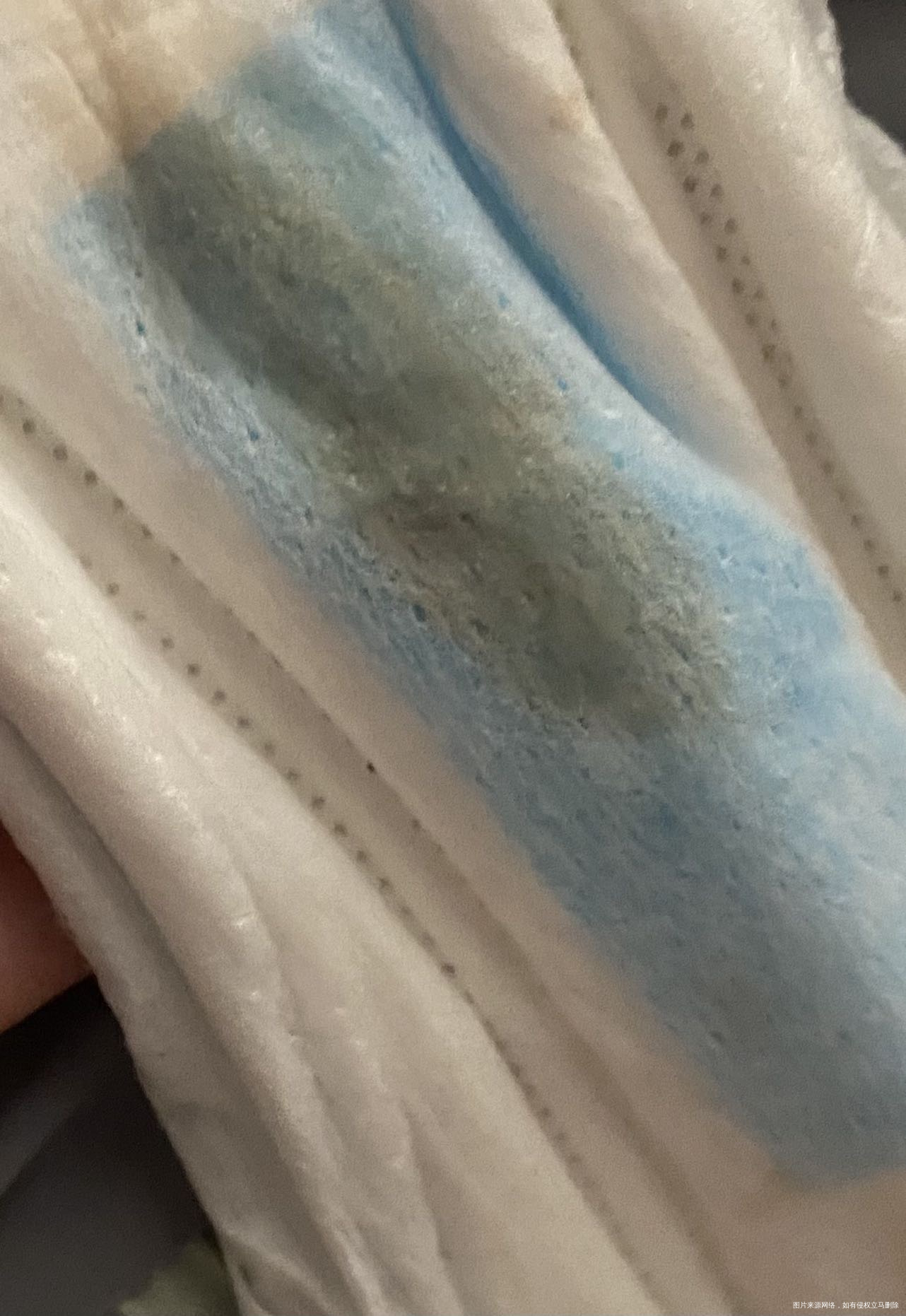 月经结束第五天分泌物这样正常吗