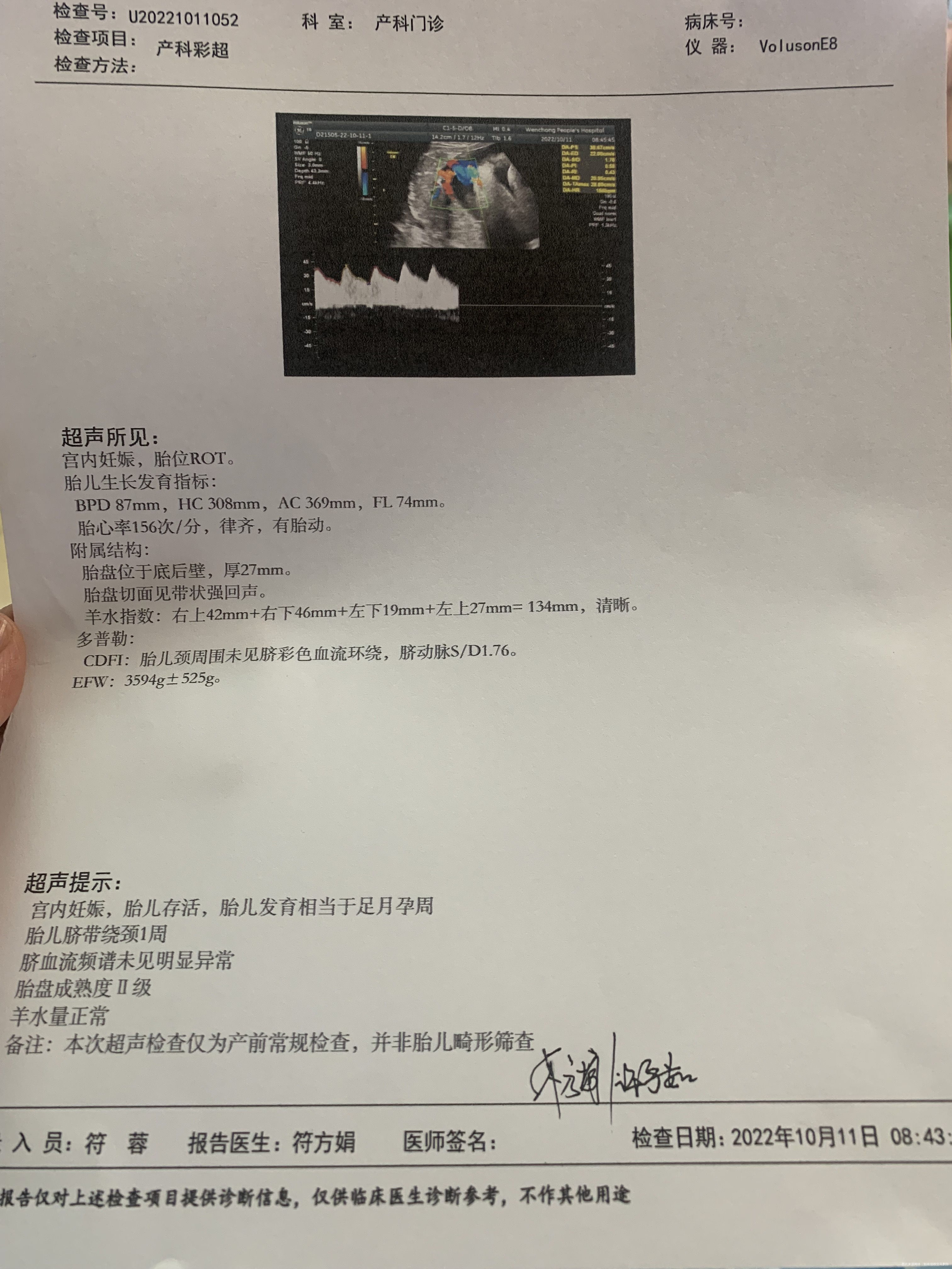 第一张是38+4做的彩超第二张是39+3的第