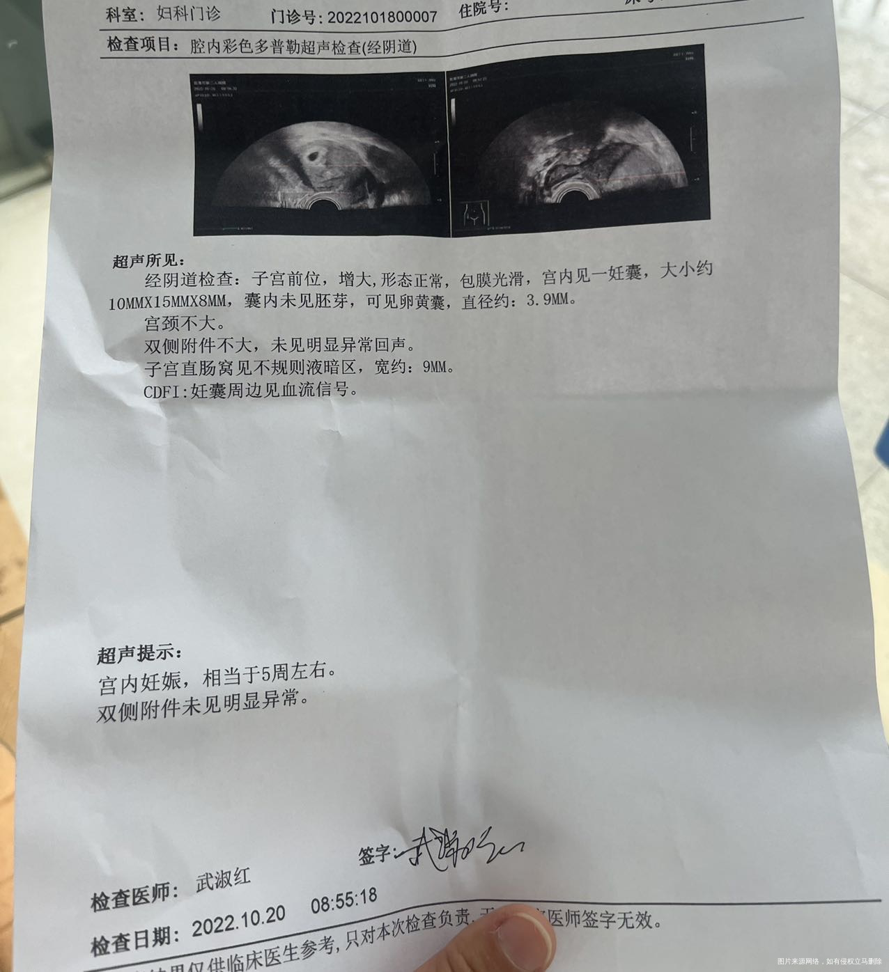 上周孕酮20这周掉了需要补孕酮吗5周了也没见