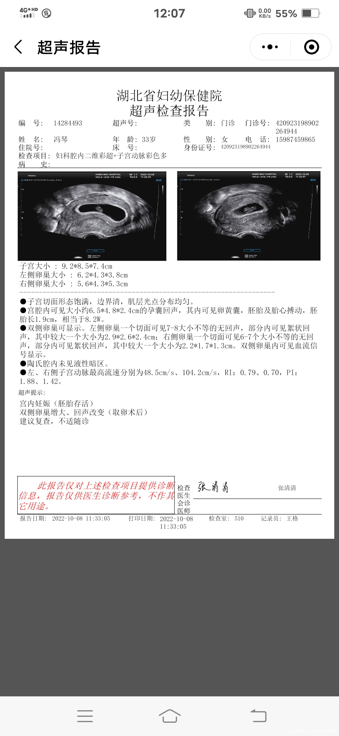 这是我鲜囊胚移植后的第42天结果不知道怎么样