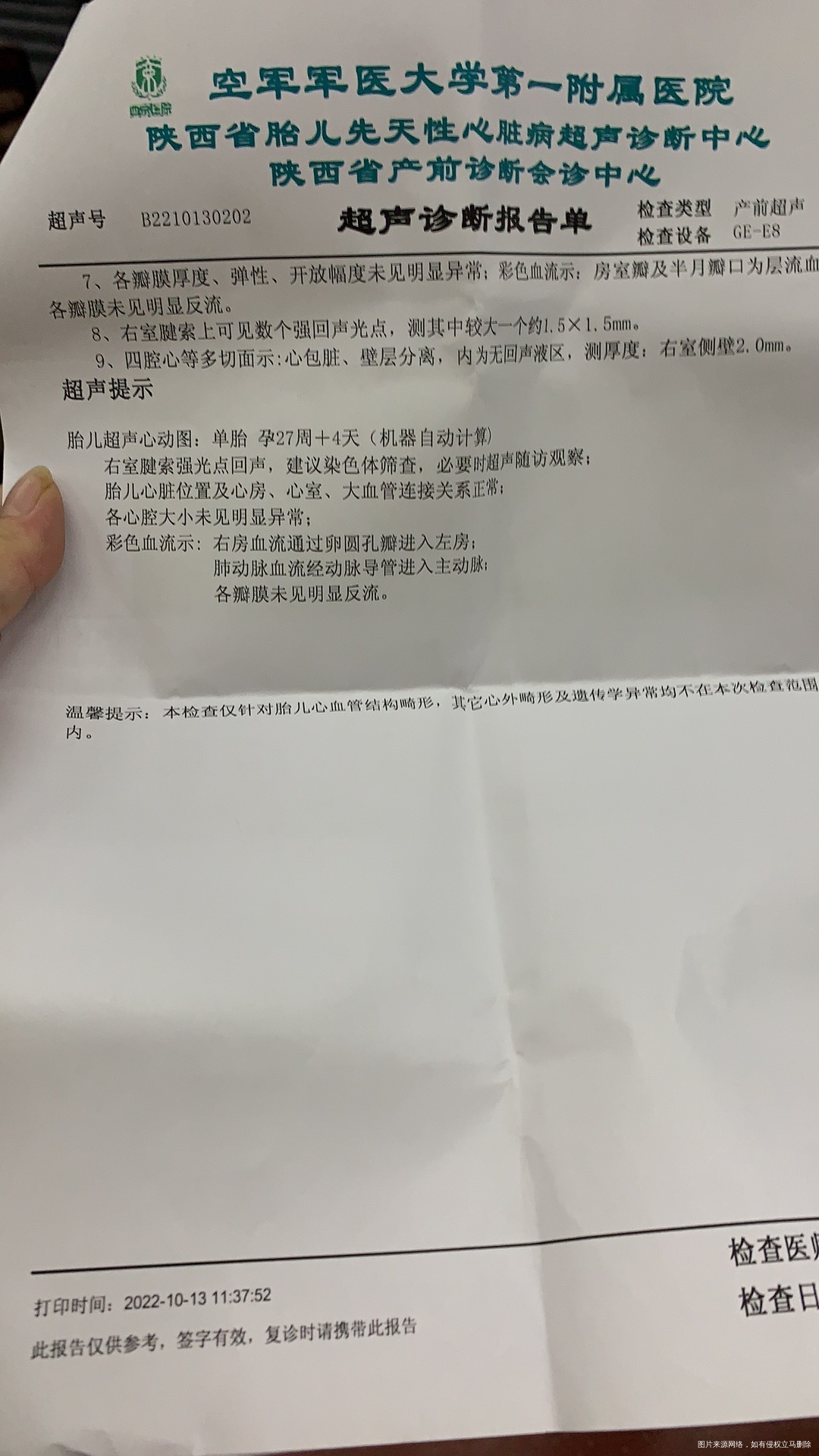 今天做了胎儿心脏彩超显示右心室有强光点还有个