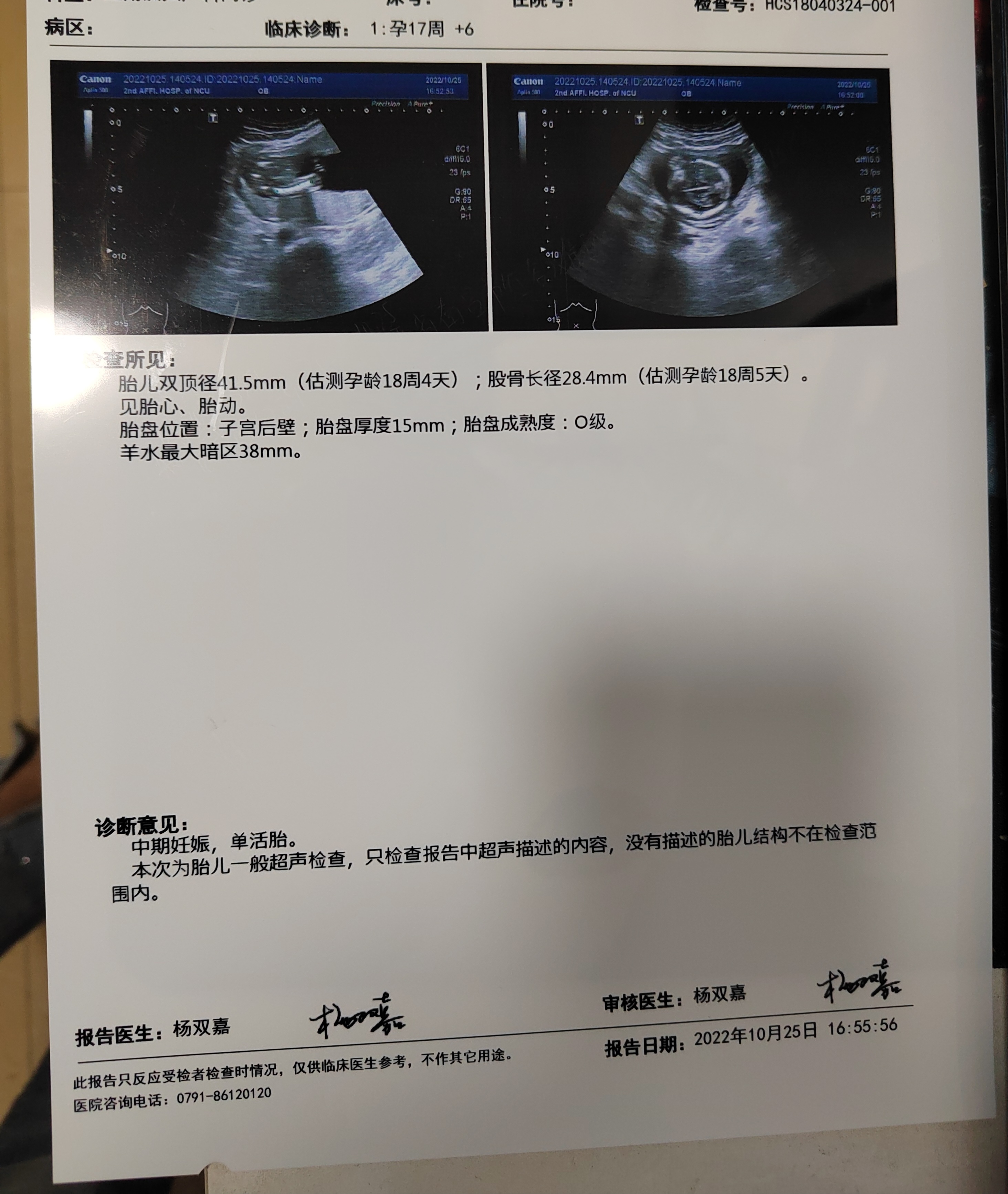 这胎儿发育的咋样啊也看不懂这数值多少合适胎儿