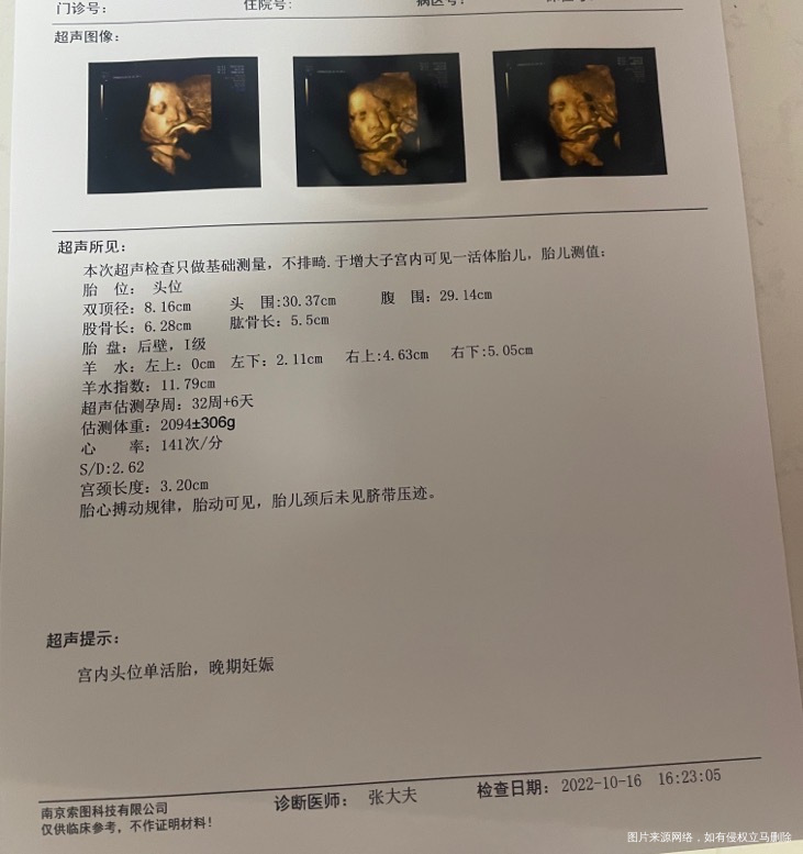 医生您好我目前怀孕怀孕34➕2天昨天去做了超