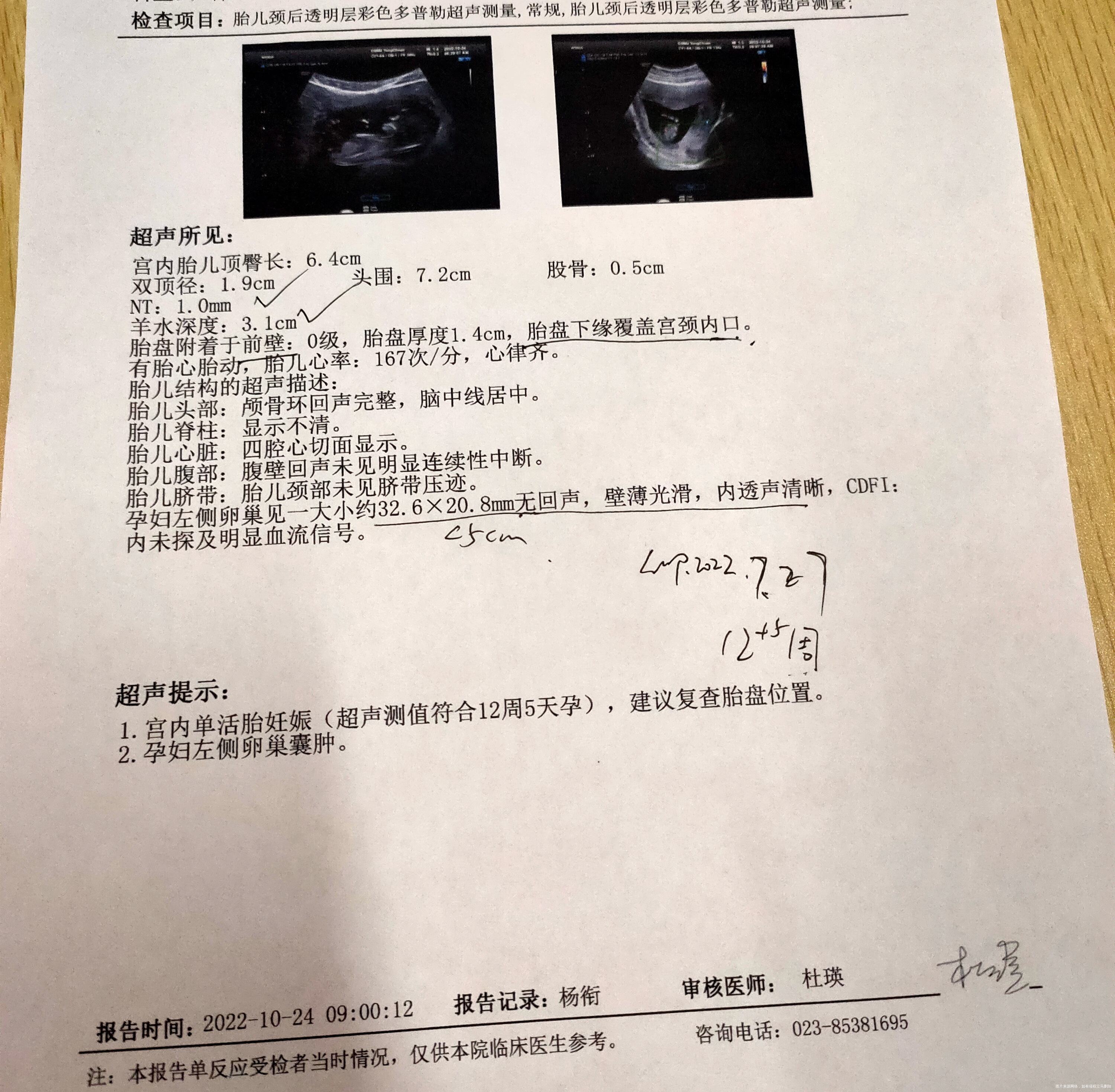 医生说胎盘位置低怎样才可以长上去呢我这个问题