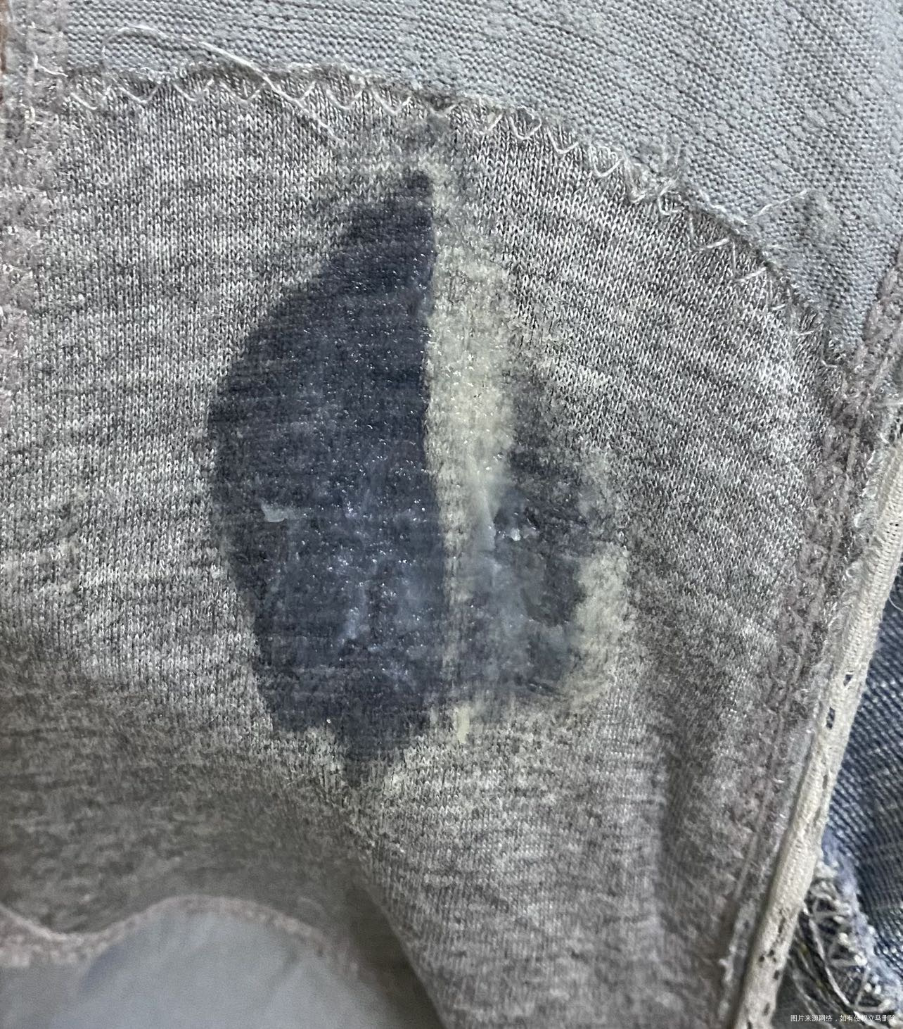 做完宫腔镜马上这几天来月经现在一走路内裤上都