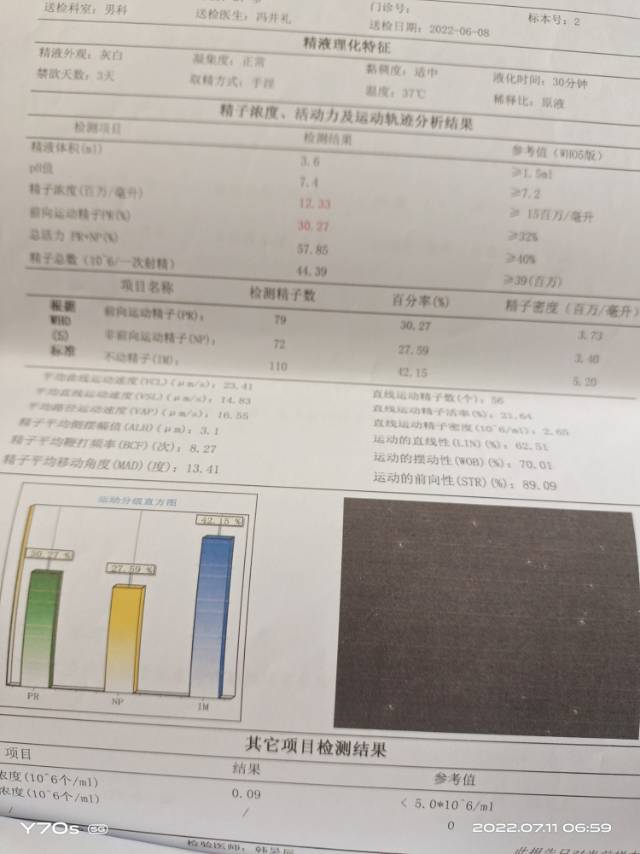 你好医生麻烦帮我看一下我这个精索静脉曲张需要