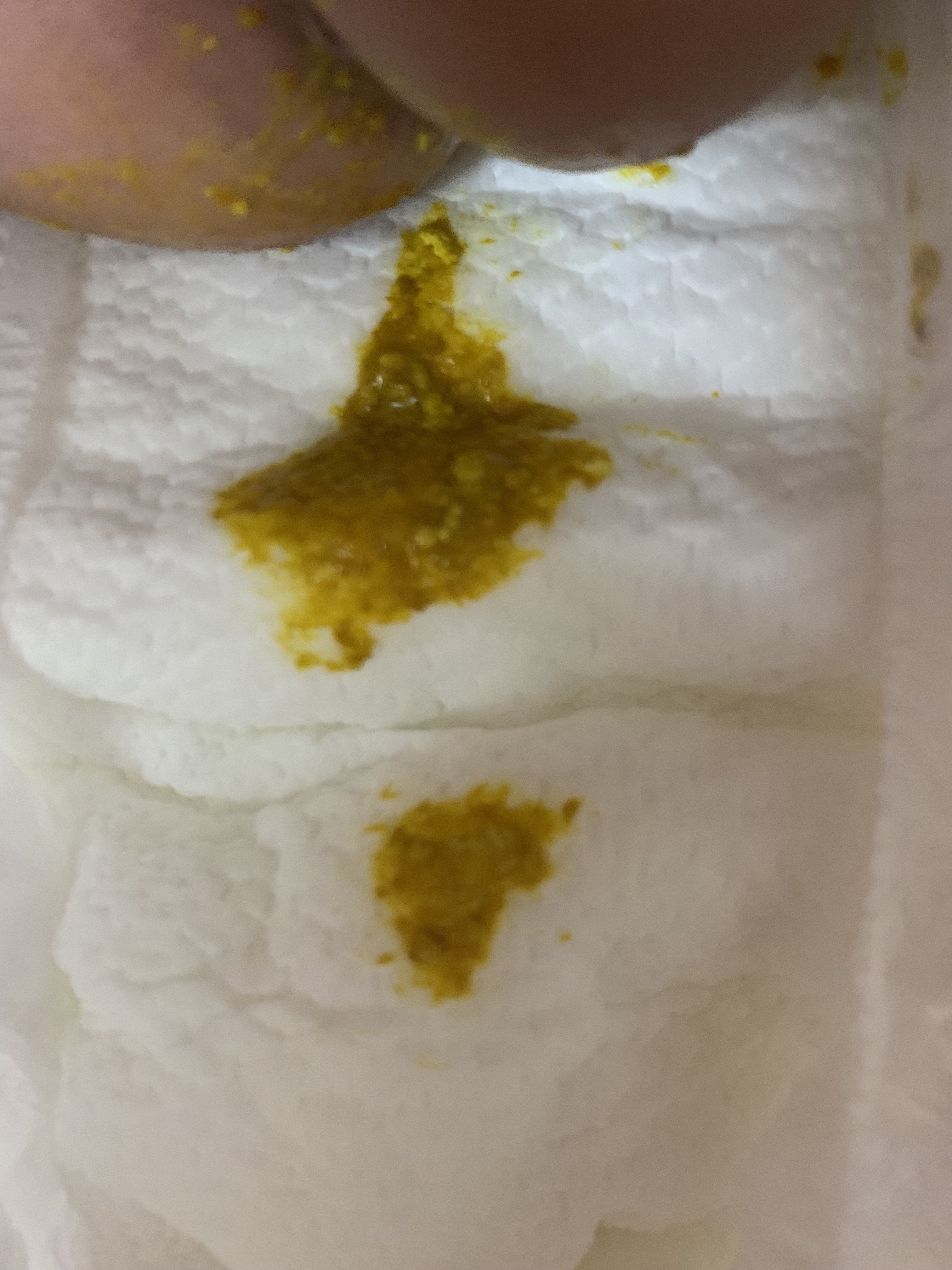 新生儿十几天每天都拉这样的大便很频繁一天十次