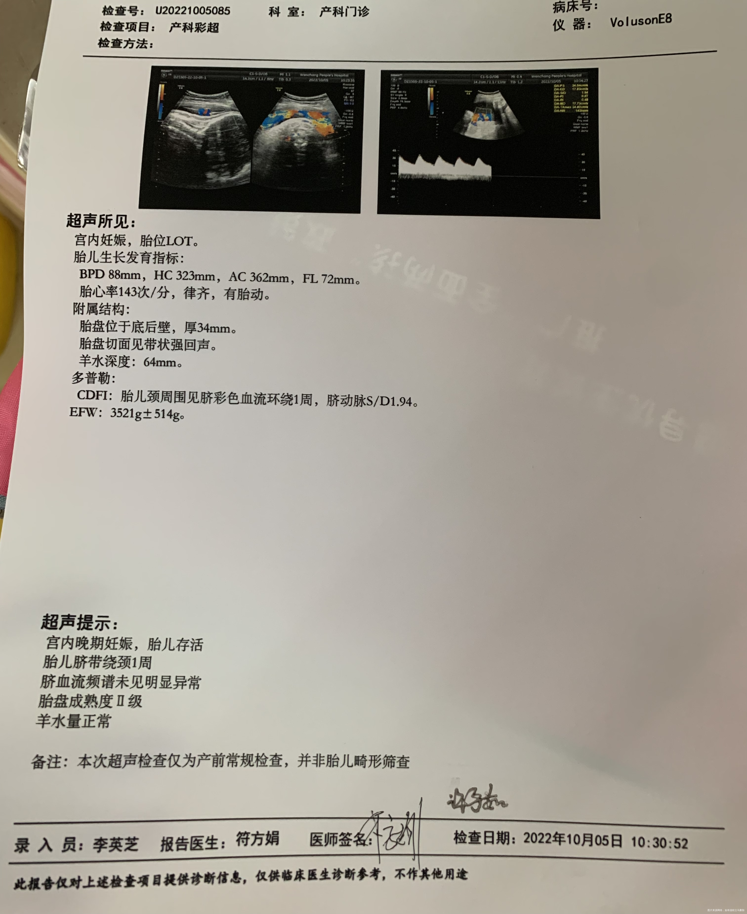 第一张是38+4做的彩超第二张是39+3的第