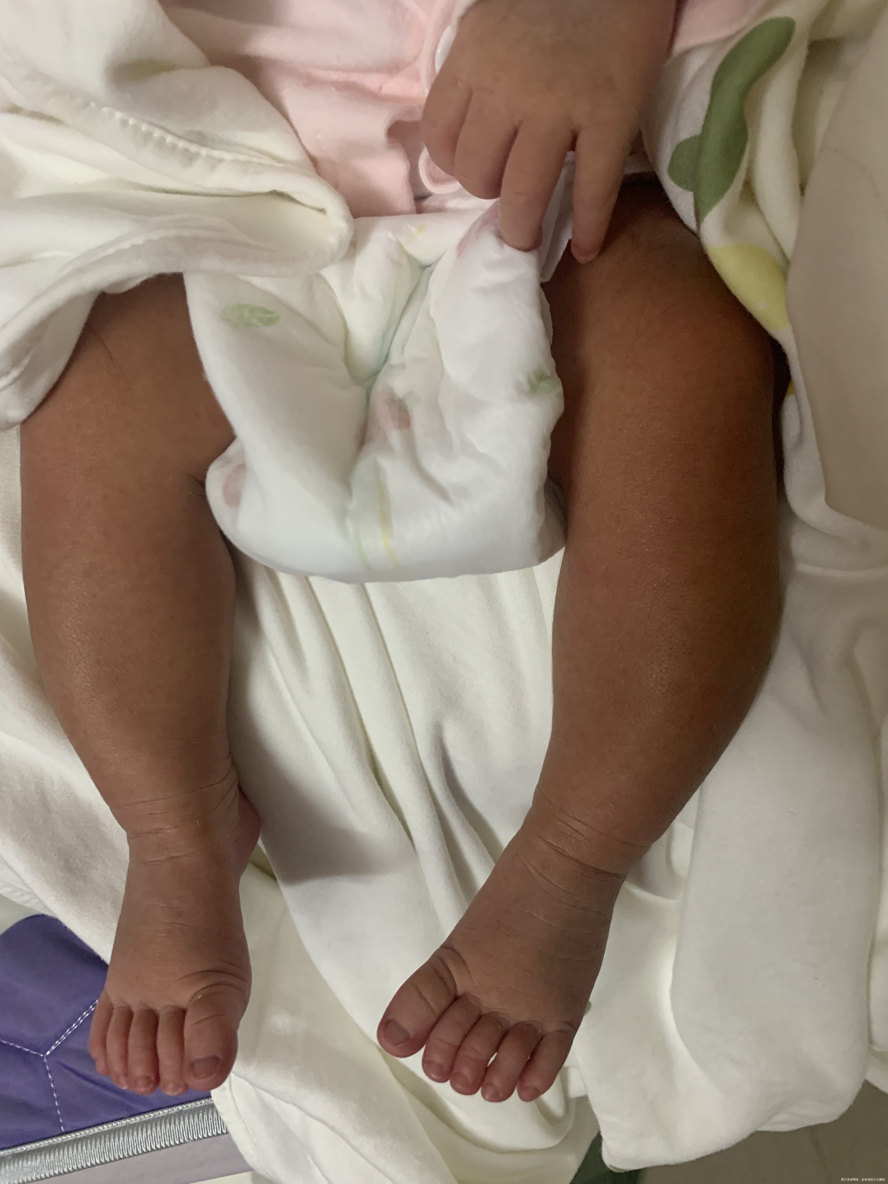 刚出生几天宝宝的脚是不是有点内八呢还是小就这