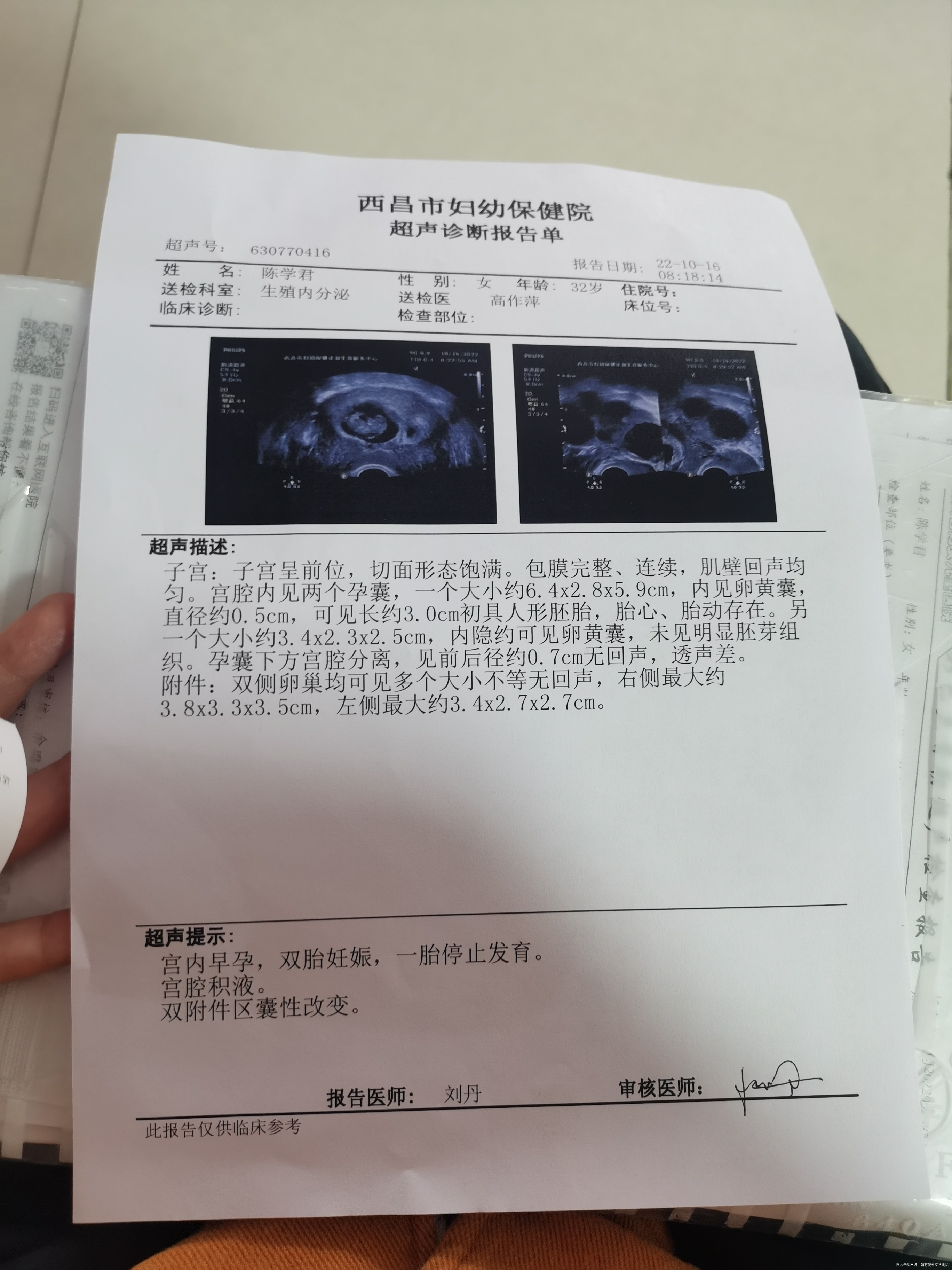 8月25日移植的2个鲜胚打阴超就有一个没有胎