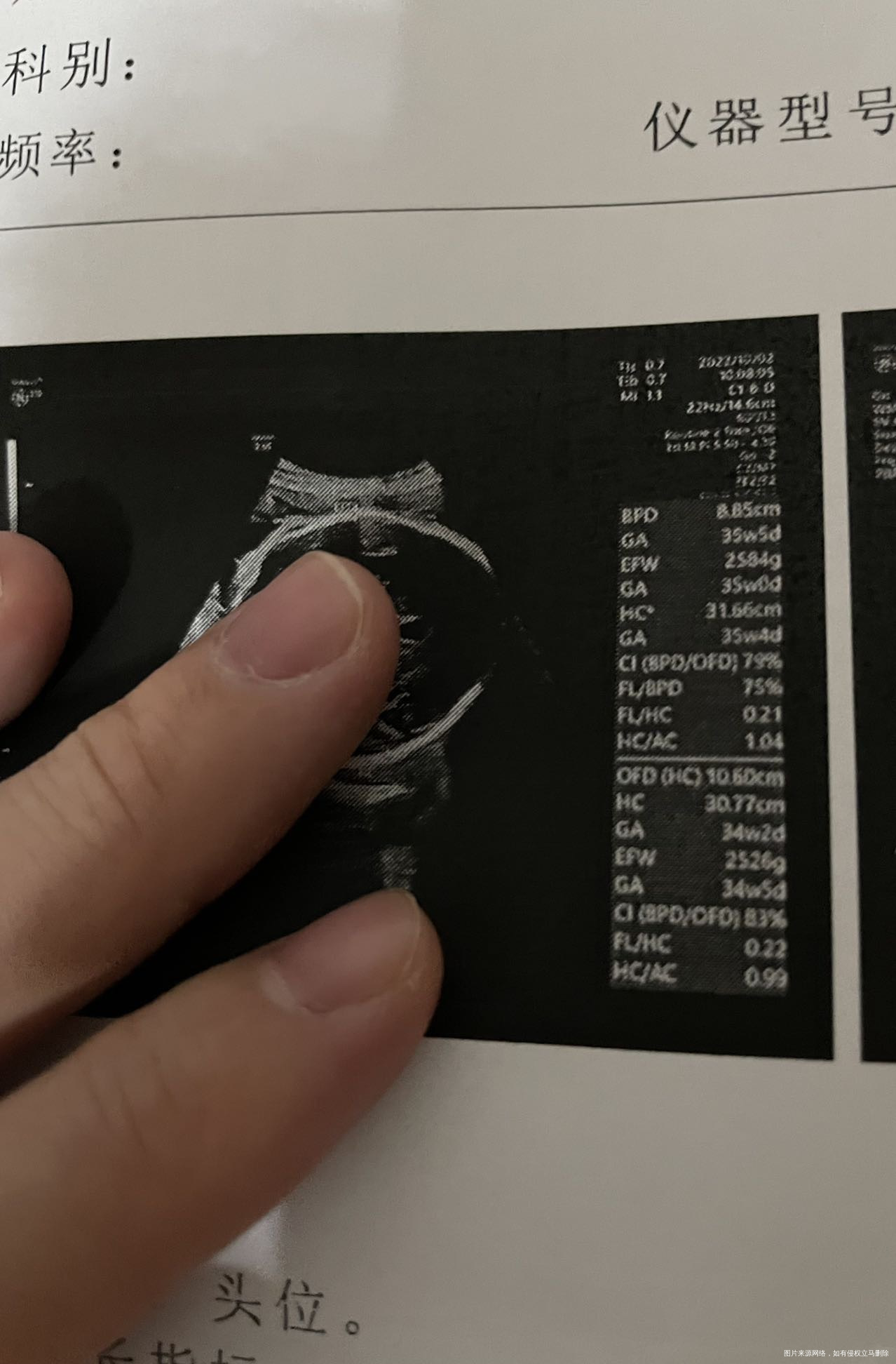 请问医生b超截图的数值是实测值吗